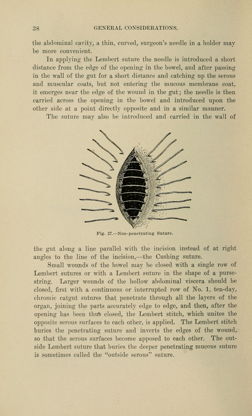 the abdominal cavity, a thin, curved, surgeon's needle in a holder may be more convenient. In apjDlying the Lembert suture the needle is introduced a short distance from the edge of the ojDening in the bowel, and after passing in the wall of the gut for a short distance and catching up the serous and muscular coats, but not entering the mucous membrane coat, it emerges near the edge of the wound in the gut; the needle is then carried across the opening in the bowel and introduced upon the other side at a point directly opposite and in a similar manner. The suture mav also be introduced and carried in the wall of Fig. 27.—Xon-penetrating Suture. the gut along a line parallel with the incision instead of at right angles to the line of the incision,—^the Gushing suture. Small wounds of the bowel may be closed with a single row of Lembert sutures or vnth a Lembert suture in the shape of a purse- string. Larger wounds of the hollow abdominal viscera should be closed, first with a continuous or interrupted row of No. 1, ten-day, chromic catgut sutures that penetrate through all the layers of the organ, joining the parts accurately edge to edge, and then, after the opening has Ijeen thu'S closed, the Lembert stitch, which unites the opposite serous surfaces to each other, is applied. The Lembert stitch buries the penetrating suture and inverts the edges of the wound, so that the serous surfaces become apposed to each other. The out- side Lembert suture that buries the deeper penetrating mucous suture is sometimes called the '^outside serous suture.