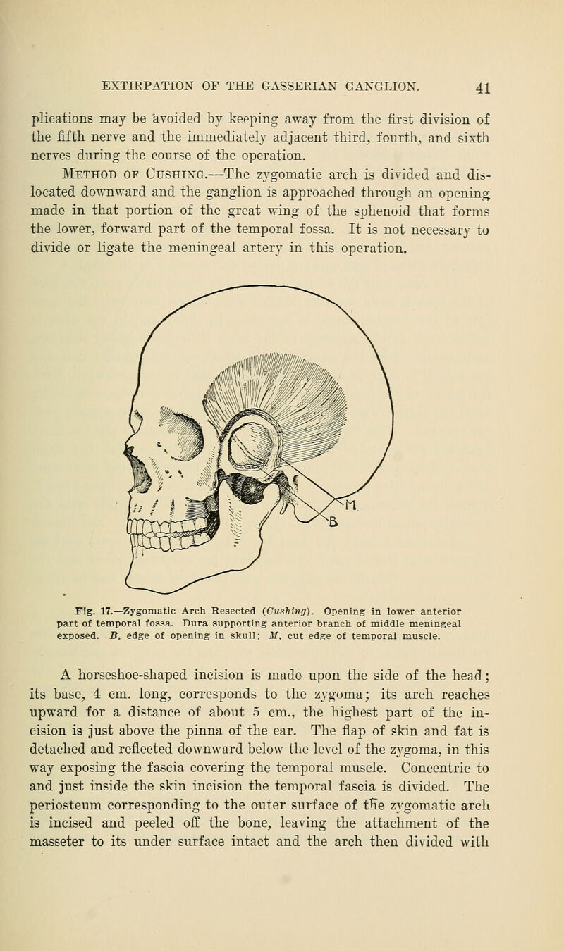 plications may be avoided by keeping away from the first division of the fifth nerve and the immediately adjacent third, fourth, and sixth nerves during the course of the operation. Method of Cushixg.—The zygomatic arch is divided and dis- located downward and the ganglion is approached through an opening made in that portion of the great wing of the sphenoid that forms the lower, forward part of the temporal fossa. It is not necessary to divide or ligate the meningeal artery in this operation. Fig. 17.—Zygomatic Arch Resected (Gushing). Opening in lower anterior part of temporal fossa. Dura supporting anterior branch of middle meningeal exposed. B, edge of opening in skull; M, cut edge of temporal muscle. A horseshoe-shaped incision is made upon the side of the head; its base, 4 cm. long, corresponds to the zygoma; its arch reaches upward for a distance of about 5 cm., the highest part of the in- cision is just above the pinna of the ear. The flap of skin and fat is detached and reflected downward below the level of the zygoma, in this way exposing the fascia covering the temporal muscle. Concentric to and just inside the skin incision the temporal fascia is divided. The periosteum corresponding to the outer surface of tEe zygomatic arch is incised and peeled off the bone, leaving the attachment of the masseter to its under surface intact and the arch then divided with