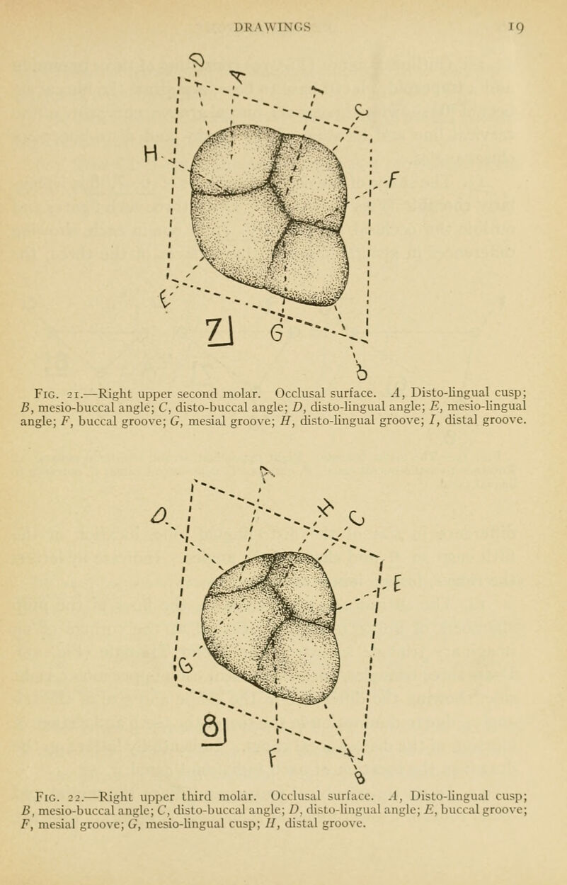 71 6---^. Fig. 21.—Right upper second molar. Occlusal surface. A, Disto-lingual cusp; B, mesio-buccal angle; C, disto-buccal angle; D, disto-lingual angle; E, mesio-lingual angle; F, buccal groove; G, mesial groove; //, disto-lingual groove; I, distal groove. ^. '>. ^ 1^ §} -f-.A ^E Fig. 22.—Right upper third molar. Occlusal surface. .1, Disto-lingual cusp; B, mesio-buccal angle; C, disto-buccal angle; D, disto-hngual angle; E, buccal groove; F, mesial groove; G, mesio-lingual cusp; //, distal groove.