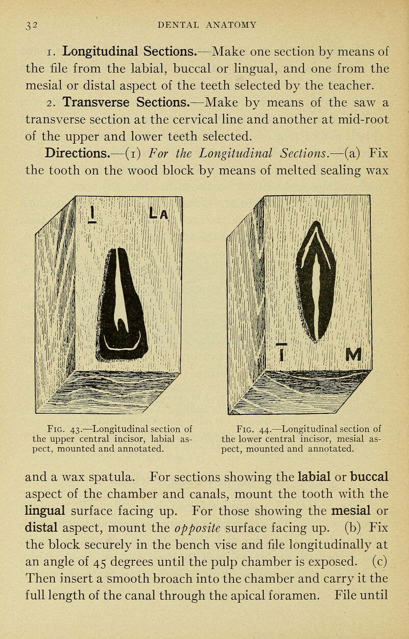 1. Longitudinal Sections.—Make one section by means of the file from the labial, buccal or lingual, and one from the mesial or distal aspect of the teeth selected by the teacher. 2. Transverse Sections.—Make by means of the saw a transverse section at the cervical line and another at mid-root of the upper and lower teeth selected. Directions.—(i) For the Longitudinal Sections.—(a) Fix the tooth on the wood block by means of melted sealing wax Fig. 43.—^Longitudinal section of the upper central incisor, labial as- pect, mounted and annotated. Fig. 44.—^Longitudinal section of the lower central incisor, mesial as- pect, mounted and annotated. and a wax spatula. For sections showing the labial or buccal aspect of the chamber and canals, mount the tooth with the lingual surface facing up. For those showing the mesial or distal aspect, mount the opposite surface facing up. (b) Fix the block securely in the bench vise and file longitudinally at an angle of 45 degrees until the pulp chamber is exposed, (c) Then insert a smooth broach into the chamber and carry it the full length of the canal through the apical foramen. File until