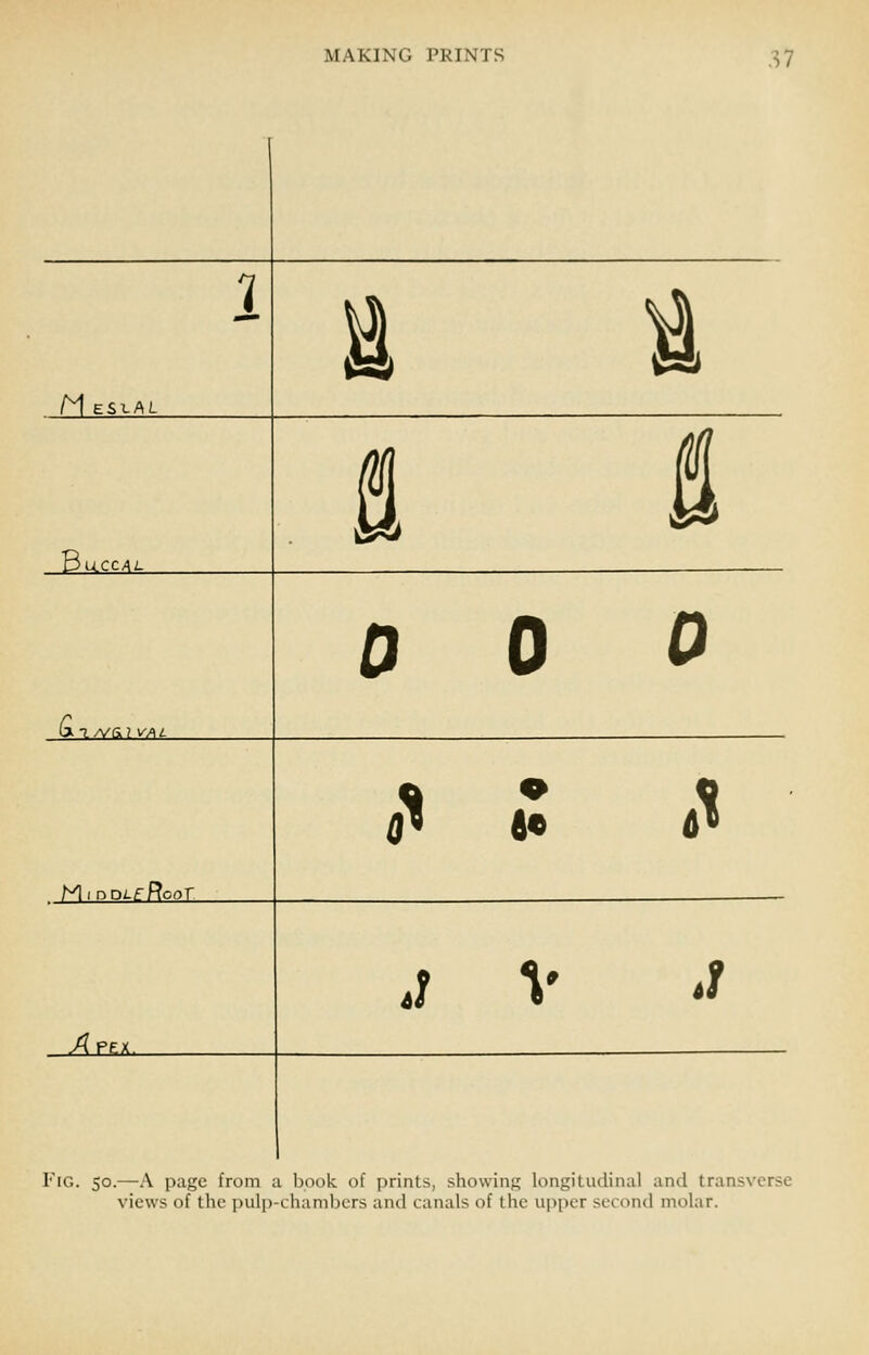 1 E t M EStAL fl, s SuCCAL a.T./V&? VAi. 0 0 0 MiDOuRcoT .^ • 1^ J V J Apex Fig. 50.—A page from a book of prints, showing longitudinal and transverse views of the pulp-chambers and canals of the upper second molar.