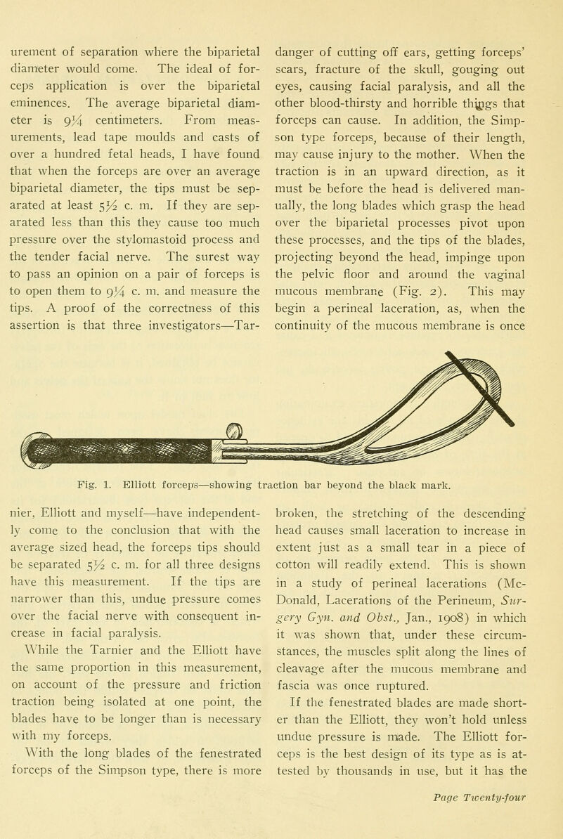 urement of separation where the biparietal diameter would come. The ideal of for- ceps application is over the biparietal eminences. The average biparietal diam- eter is 9^ centimeters. From meas- urements, lead tape moulds and casts of over a hundred fetal heads, I have found that when the forceps are over an average biparietal diameter, the tips must be sep- arated at least 5>4 c. m. If they are sep- arated less than this they cause too much pressure over the stylomastoid process and the tender facial nerve. The surest way to pass an opinion on a pair of forceps is to open them to g}i c. m. and measure the tips. A proof of the correctness of this assertion is that three investigators—Tar- danger of cutting off ears, getting forceps' scars, fracture of the skull, gouging out eyes, causing facial paralysis, and all the other blood-thirsty and horrible th^igs that forceps can cause. In addition, the Simp- son type forceps, because of their length, may cause injury to the mother. When the traction is in an upward direction, as it must be before the head is delivered man- ually, the long blades which grasp the head over the biparietal processes pivot upon these processes, and the tips of the blades, projecting beyond the head, impinge upon the pelvic floor and around the vaginal mucous membrane (Fig. 2). This may begin a perineal laceration, as, when the continuity of the mucous membrane is once Fig. 1. Elliott forceps—showing traction bar beyond the black mark. nier, Elliott and myself—have independent- ly come to the conclusion that with the average sized head, the forceps tips should be separated 5^ c. m. for all three designs have this measurement. If the tips are narrower than this, undue pressure comes over the facial nerve with consequent in- crease in facial paralysis. While the Tarnier and the Elliott have the same proportion in this measurement, on account of the pressure and friction traction being isolated at one point, the blades have to be longer than is necessary with my forceps. With the long blades of the fenestrated forceps of the Simpson type, there is more broken, the stretching of the descending head causes small laceration to increase in extent just as a small tear in a piece of cotton will readily extend. This is shown in a study of perineal lacerations (Mc- Donald, Lacerations of the Perineum, Sur- gery Gyn. and Ob St., Jan., 1908) in which it was shown that, under these circum- stances, the muscles split along the lines of cleavage after the mucous membrane and fascia was once ruptured. If the fenestrated blades are made short- er than the Elliott, they won't hold unless undue pressure is made. The Elliott for- ceps is the best design of its type as is at- tested by thousands in use, but it has the