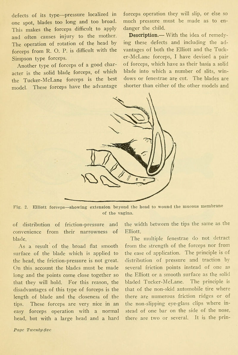 defects of its type—pressure localized in one spot, blades too long- and too broad. This makes the forceps difficult to apply and often causes injury to the mother. The operation of rotation of the head by forceps from R. O. P. is difficult with the Simpson type forceps. Another type of forceps of a good char- acter is the solid blade forceps, of which the Tucker-McLane forceps is the best model. These forceps have the advantage forceps operation they will slip, or else so much pressure must be made as to en- danger the child. Description.— With the idea of remedy- ing these defects and including the ad- vantages of both the Elliott and the Tuck- er-McLane forceps, I have devised a pair of forceps, which have as their basis a solid blade into which a number of slits, win- dows or fenestrae are cut. The blades are shorter than either of the other models and Fi.£ 2. Elliott forceps—showing extension beyond the head to wound the mucous membrane of the vagina. of distribution of friction-pressure and convenience from their narrowness of blade. As a result of the broad flat smooth surface of the blade which is applied to the head, the friction-pressure is not great. On this account the blades must be made long and the points come close together so that they will hold. For this reason, the disadvantages of this type of forceps is the length of blade and the closeness of the tips. These forceps are very nice in an easy forceps operation with a normal head, but with a large head and a hard the width between the tips the same as the Elliott. The multiple fenestrae do not detract from the strength of the forceps nor from the ease of application. The principle is of distribution of pressure and traction by several friction points instead of one as the Elliott or a smooth surface as the solid bladed Tucker-McLane. The principle is that of the non-skid automobile tire where there are numerous friction ridges or of the non-slipping eye-glass clips where in- stead of one bar on the side of the nose, there are two or several. It is the prin-