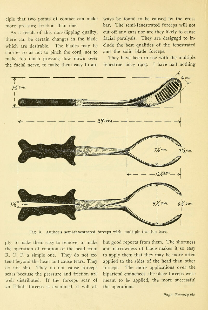 ciple that two points of contact can make more pressure friction than one. As a result of this non-sHpping quality, there can be certain changes in the blade which are desirable. The blades may be shorter so as not to pinch the cord, not to make too much pressure low down over the facial nerve, to make them easy to ap- ways be found to be caused by the cross bar. The semi-fenestrated forceps will not cut off any ears nor are they likely to cause facial paralysis. They are desigr^d to in- clude the best qualities of the fenestrated and the solid blade forceps. They have been in use with the multiple fenestrae since 1905. I have had nothing <r- 37OW. 1 — jJi* c/m. SA'e^. Fig. 3. Author's semi-fenestrated forceps with multiple traction bars. ply, to make them easy to remove, to make the operation of rotation of the head from R. O. P. a simple one. They do not ex- tend beyond the head and cause tears. They do not slip. They do not cause forceps scars because the pressure and friction are well distributed. If the forceps scar of an Elliott forceps is examined, it will al- but good reports from them. The shortness and narrowness of blade makes it so easy to apply them that they may be more often applied to the sides of the head than other forceps. The more applications over the biparietal eminences, the place forceps were meant to be applied, the more successful the operations.