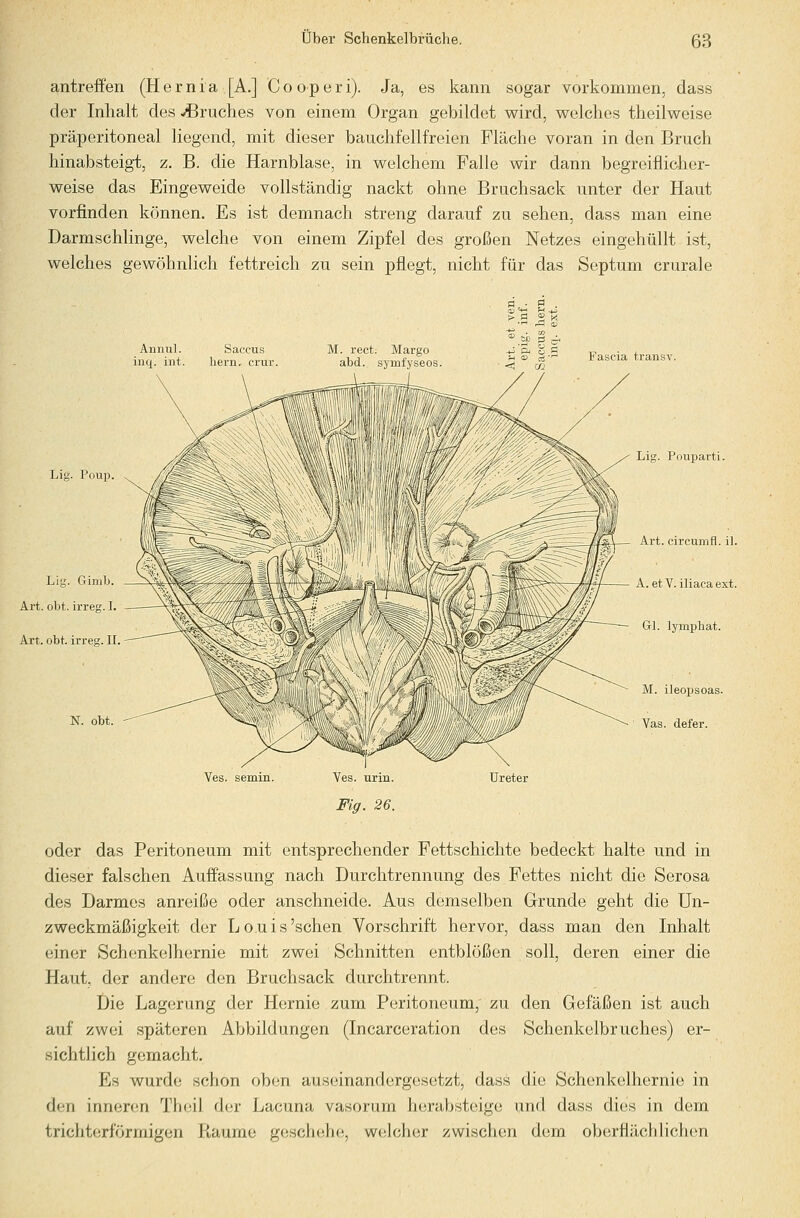 antreffen (Hernia [A.] Cooperi). Ja, es kann sogar vorkommen, dass der Inhalt des -Bruches von einem Organ gebildet wird, welches theilweise präperitoneal liegend, mit dieser bauchfellfreien Fläche voran in den Bruch hinabsteigt, z. B. die Harnblase, in welchem Falle wir dann begreiflidier- weise das Eingeweide vollständig nackt ohne Bruchsack unter der Haut vorfinden können. Es ist demnach streng darauf zu sehen, dass man eine Darmschlinge, welche von einem Zipfel des großen Netzes eingehüllt ist, welches gewöhnlich fettreich zu sein pflegt, nicht für das Septum crurale ;> fl » M Annul. inq int Lig. Poup. Llg. Gimb. Art. obt. irreg. I. Art. obt. irre^r. II. N. obt. Lig. Pouparti. Art. circumfl. il. — A. etV. iliacaext. Gl. lymphat. M. ileopsoas. Vas. defer. Ves. semin. Ves. urin. Fig. 26. Ureter oder das Peritoneum mit entsprechender Fettschichte bedeckt halte und in dieser falschen Auffassung nach Durchtrennung des Fettes nicht die Serosa des Darmes anreiße oder anschneide. Aus demselben Grunde geht die Un- zWeckmäßigkeit der Louis'sehen Vorschrift hervor, dass man den Inhalt einer Schenkelhernie mit zwei Schnitten entblößen soll, deren einer die Haut, der andere den Bruchsack durchtrennt. Die Lagerung der Hernie zum Peritoneum, zu den Gefäßen ist auch auf zwei späteren Abbildungen (Incarceration des Schenkelbruches) er- sichtlich gemacht. Es wurde schon oben aus(3inand ergesetzt, dass die Schenkelhernie in den inneren Theil der Lacuna vasorum herabsteige und dass dies in dem trichterförmigen Ptaume geschehe, welcher zwischen dem oberflächlichen