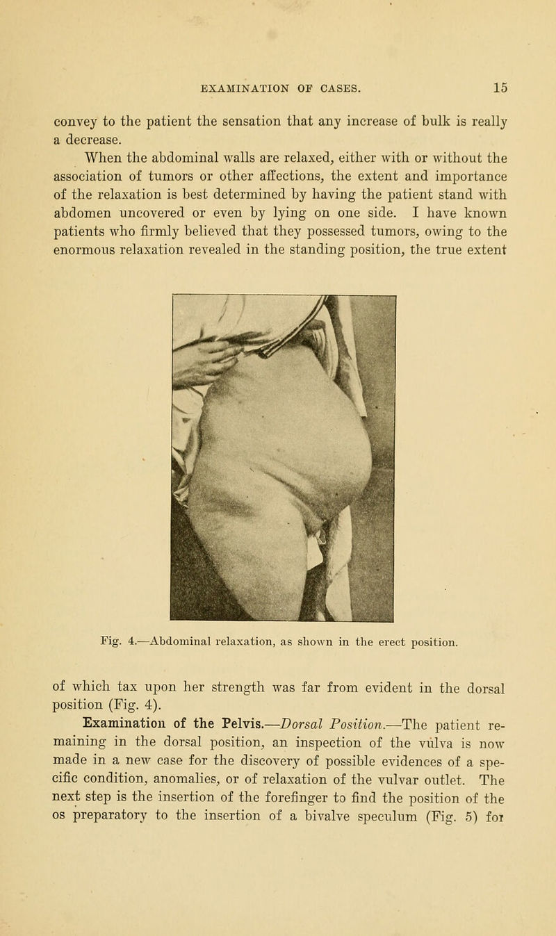 convey to the patient the sensation that any increase of bulk is really a decrease. When the abdominal walls are relaxed, either with or without the association of tumors or other affections, the extent and importance of the relaxation is best determined by having the patient stand with abdomen uncovered or even by lying on one side. I have known patients who firmly believed that they possessed tumors, owing to the enormous relaxation revealed in the standing position, the true extent Fig. 4.—Abdominal relaxation, as shown in the erect position. of which tax upon her strength was far from evident in the dorsal position (Fig. 4). Examination of the Pelvis.—Dorsal Position.~The patient re- maining in the dorsal position, an inspection of the vulva is now made in a new case for the discovery of possible evidences of a spe- cific condition, anomalies, or of relaxation of the vulvar outlet. The next step is the insertion of the forefinger to find the position of the OS preparatory to the insertion of a bivalve speculum (Fig. 5) foi