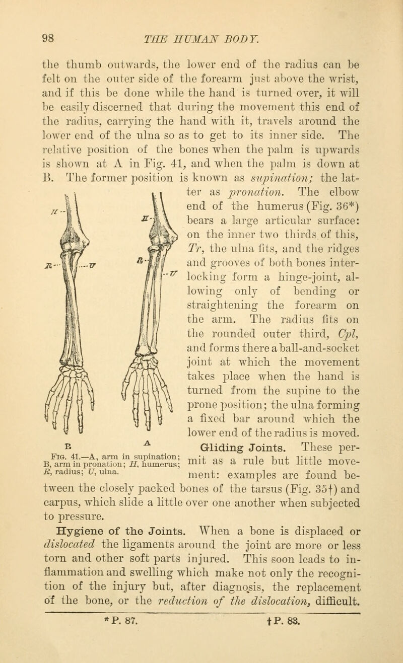 the thumb outwards, the lower end of the radius can be felt on the outer side of the forearm just above the wrist, and if this be done while the hand is turned over, it will l)e easily discerned that during the movement this end of the radius, carrying the hand with it, travels around the lower end of the nlna so as to get to its inner side. The relative position of the bones when the palm is upwards is shown at A in Fig. 41, and when the palm is down at B. The former position is known as supination; the lat- ter as pronation. The elbow end of the humerus (Fig, 36*) bears a large articular surface: on the inner two thirds, of this, Tr, the ulna fits, and the ridges R- ■V and grooves of both bones inter- locking form a hinge-joint, al- lowing only of bending or straightening the forearm on the arm. The radius fits on the rounded outer third, Cpl, and forms there a ball-and-socket joint at which the movement takes place when the hand is turned from the supine to the prone position; the ulna forming a fixed bar around which the lower end of the radius is moved. Gliding Joints. These per- mit as a rule but little move- ment: examples are found be- tween the closely packed bones of the tarsus (Fig. 35 f) and carpus, which slide a little over one another when subjected to pressure. Hygiene of the Joints. AYlien a bone is displaced or dislocated the ligaments around the joint are more or less torn and other soft parts injured. This soon leads to in- flammation and swelling which make not only the recogni- tion of the injury but, after diaguo.sis, the replacement of the bone, or the reduction of the dislocation, difficult. Fig. 41.—A, arm in supination; B, arm in pronation; if, humerus; B, radius; 17, ulna. » P. 87. fP. 83.