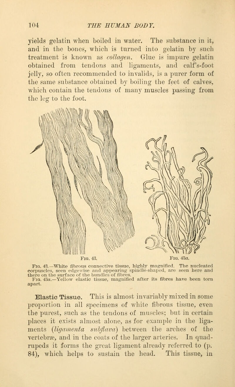 yields gelatin when boiled in water. The substance in it, and in tlie bones, which is turned into gelatin by such treatment is known as collagen. Glue is impure gelatin obtained from tendons and ligaments, and calf's-foot jelly, so often recommended to invalids, is a purer form of the same substance obtained by boiling the feet of calves, which contain the tendons of many muscles passing from the k'o; to the foot. Fig. 43. Fig. 43a. Fig. 43.—White fibrous connective tissue, highly magnified. The nucleated corpuscles, seen edgewise and appearing spindle-shaped, are seen here and there on the surface of the bundles of fibres. Fig. 43a.—Yellow elastic tissue, magnified after its fibres have been torn apart. Elastic Tissue. This is almost invariably mixed in some proportion in all specimens of white fibrous tissue, even the purest, such as the tendons of muscles; but in certain places it exists almost alone, as for example in the liga- ments {ligamenta suhjiava) between the arches of the vertebra?, and in the coats of the larger arteries. In quad- rupeds it forms the great ligament already referred to (p. 84), which helps to sustain the head. This tissue, in