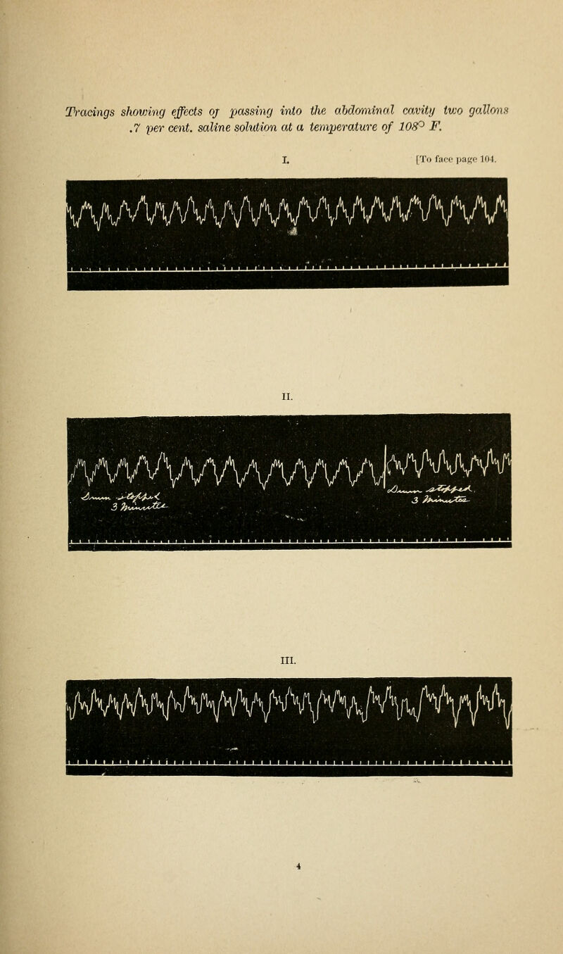 Tracings shovnng effects oj passing into the oMoniina.l mvity two gallons .7 per cent, saline solution at a temperature of 10^ F. I, [To face pagf 104. MPMtH\J'H\MAN'^W^' 3 ht^i^^^^fy^^-