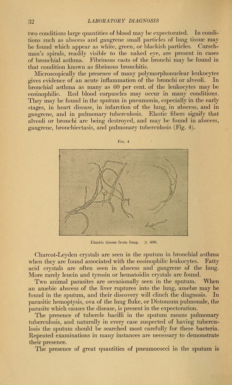 two conditions large quantities of blood may be expectorated. In condi- tions such as abscess and gangrene small particles of lung tissue may be found which appear as white, green, or blackish particles. Cursch- man's spirals, readily visible to the naked eye, are present in cases of bronchial asthma. Fibrinous casts of the bronchi may be found in that condition known as fibrinous bronchitis. Microscopically the presence of many polymorphonuclear leukocytes gives evidence of an acute inflammation of the bronchi or alveoli. In bronchial asthma as many as 60 per cent, of the leukocytes may be eosinophilic. Red blood corpuscles may occur in many conditions. They may be found in the sputum in pneumonia, especially in the early stages, in heart disease, in infarction of the lung, in abscess, and in gangrene, and in pulmonary tuberculosis. Elastic fibers signify that alveoli or bronchi are being destroyed, and may be found in abscess, gangrene, bronchiectasis, and pulmonary tuberculosis (Fig. 4). Fig. 4 Elastic tissue from lung. X 400. Charcot-Leyden crystals are seen in the sputum in bronchial asthma when they are found associated with the eosinophilic leukocytes. Fatty acid crystals are often seen in abscess and gangrene of the lung. More rarely leucin and tyrosin or hematoidin crystals are found. Two animal parasites are occasionally seen in the sputum. When an amebic abscess of the liver ruptures into the lung, amebse may be found in the sputum, and their discovery will clinch the diagnosis. In parasitic hemoptysis, ova of the lung fluke, or Distomum pulmonale, the parasite which causes the disease, is present in the expectoration. The presence of tubercle bacilli in the sputum means pulmonary tuberculosis, and naturally in every case suspected of having tubercu- losis the sputum should be searched most carefully for these bacteria. Repeated examinations in many instances are necessary to demonstrate their presence. The presence of great quantities of pneumococci in the sputum is