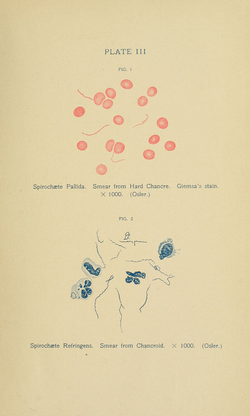 PLATE 111 V y^ J Cl Spirochaste Pallida. Smear from Hard Chancre. Giemsa's stain. X 1000. (Osier.) FIG. 2 Spirochaste Refringens. Smear from Chancroid. X 1000. (Osier.)
