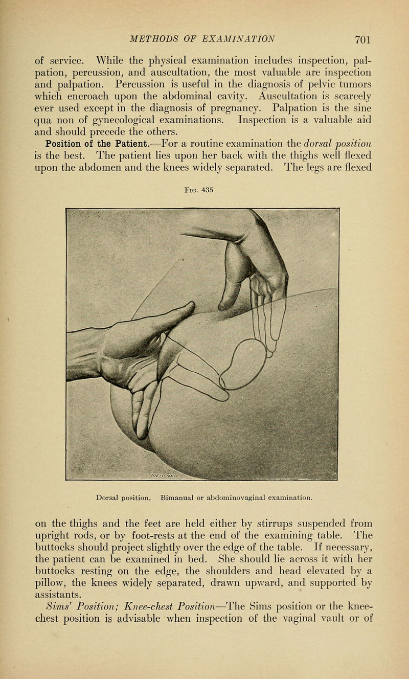 of service. While the physical examination includes inspection, pal- pation, percussion, and auscultation, the most valuable are inspection and palpation. Percussion is useful in the diagnosis of pelvic tumors which encroach upon the abdominal cavity. Auscultation is scarcely ever used except in the diagnosis of pregnancy. Palpation is the sine qua non of gynecological examinations. Inspection is a valuable aid and should precede the others. Position of the Patient.—For a routine examination the dorsal position is the best. The patient lies upon her back with the thighs well flexed upon the abdomen and the knees widely separated. The legs are flexed Fig. 435 Dorsal position. Bimanual or abdominovaginal examination. on the thighs and the feet are held either by stirrups suspended from upright rods, or by foot-rests at the end of the examining table. The buttocks should project slightly over the edge of the table. If necessary, the patient can be examined in bed. She should lie across it with her buttocks resting on the edge, the shoulders and head elevated by a pillow, the knees widely separated, drawn upv/ard, and supported by assistants. Sims' Position; Knee-chest Position—The Sims position or the knee- chest position is advisable when inspection of the vaginal vault or of