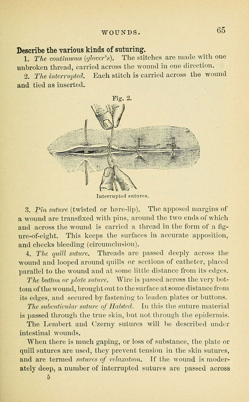 Describe the various kinds of suturing. 1. The continuous {glover's). The stitches are made with one unbroken thread, carried across the wound in one direction. 2. The interrupted. Each stitch is carried across the wound and tied as inserted. Fig. 2. Interrupted sutures. 3. Pin suture (twisted or hare-lip). The apposed margins of a wound are transfixed with pins, around the two ends of whicli and across the wound is carried a thread in the form of a fig- ure-of-eiglit. Tliis keeps the surfaces in accurate apposition, and checks bleeding (circumclusion). 4. The quill suture. Threads are passed deeply across the wound and looped around quills or sections of catheter, placed parallel to the wound and at some little distance from its edges. The button or plate suture. Wire is passed across the very bot- tom of the w^ound, brought out to the surface at some distance from its edges, and secured by fastening to leaden plates or buttons. The subcuticular suture of Halsted. In this the suture material is passed through the true skin, but not through the epidermis. The Lembert and Czerny sutures will be described under intestinal wounds. When there is much gaping, or loss of substance, the plate or quill sutures are used, they prevent tension in the skin sutures, and are termed sutttres of relaxation. If the wound is moder- ately deep, a number of interrupted sutures are passed across 5