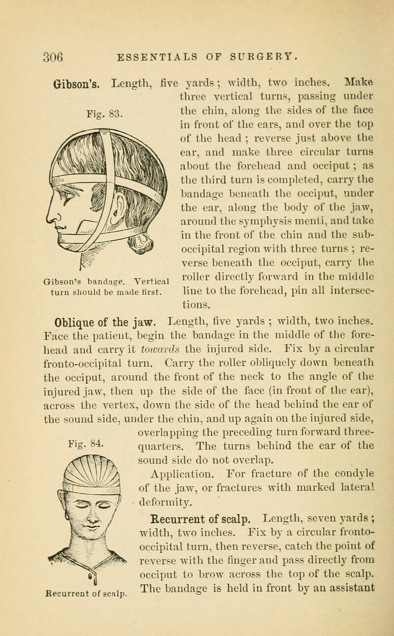 Gibson's bandage. Tertical turn should be made first. Gibson's. Length, five yards; width, two inches. Make three vertical turns, passing under pjCT_ g3 the chin, along the sides of the face in front of the ears, and over the top of the head ; reverse ju.st above the ear, and make three circular turns about the forehead and occiput; as the third turn is completed, carry the bandage beneath the occiput, under the ear, along the body of the jaw, around the symphysis nienti, and take in the front of the chin and the sub- occipital region with three turns ; re- verse beneath the occiput, carry the roller directly forward in the middle line to the forehead, pin all intersec- tions. Oblique of the jaw. Length, five yards ; width, two inches. Face the patient, begin the bandage in the middle of the fore- head and carry it Mcards the injured side. Fix by a circular fronto-occipital turn. Carry the roller obliquely down beneath the occiput, around the front of the neck to the angle of the injured jaw, then up the side of the face (in front of the ear), across the vertex, down the side of the head behind the ear of the sound side, under the chin, and up again on the injured side, overlapping the preceding turn forward three- Fig. 84. quarters. The turns behind the ear of the sound side do not overlap. Application. For fracture of the condyle of the jaw, or fractures with marked lateral deformitj'. Recurrent of scalp. Length, seven yards ; width, two inches. Fix by a circular fronto- occipital turn, then reverse, catch the point of reverse with the finger and pass directly from occiput to brow across the top of the scalp. Recurrent of scalp. The bandage is held in front by an assistant