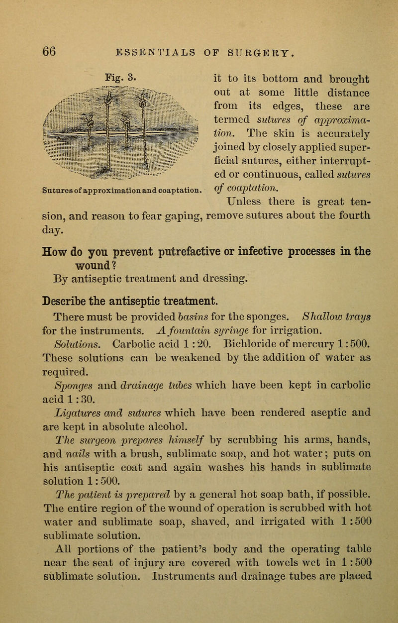 it to its bottom and brought out at some little distance from its edges, these are termed sutures of approxima- tion. The skin is accurately joined by closely applied super- ficial sutures, either interrupt- ed or continuous, called sutures Sutures of approximation and coaptation. OJ coaptation. Unless there is great ten- sion, and reason to fear gaping, remove sutures about the fourth day. How do you prevent putrefactive or infective processes in the wound ? By antiseptic treatment and dressing. Describe the antiseptic treatment. There must be provided hasins for the sponges. Shallow trays for the instruments. A fountain syringe for irrigation. Solutions. Carbolic acid 1: 20. Bichloride of mercury 1: 500. These solutions can be weakened by the addition of water as required. Sponges and drainage Uibes which have been kept in carbolic acid 1: 30. Ligatures and sutures which have been rendered aseptic and are kept in absolute alcohol. The surgeon prepares himself by scrubbing his arms, hands, and nails with a brush, sublimate soap, and hot water; puts on his antiseptic coat and again washes his hands in sublimate solution 1: 500. The patient is ])repared by a general hot soap bath, if possible. The entire region of the wound of operation is scrubbed with hot water and sublimate soap, shaved, and irrigated with 1:500 sublimate solution. All portions of the patient's body and the operating table near the seat of injury are covered with towels wet in 1: 500 sublimate solution. Instruments and drainage tubes are placed