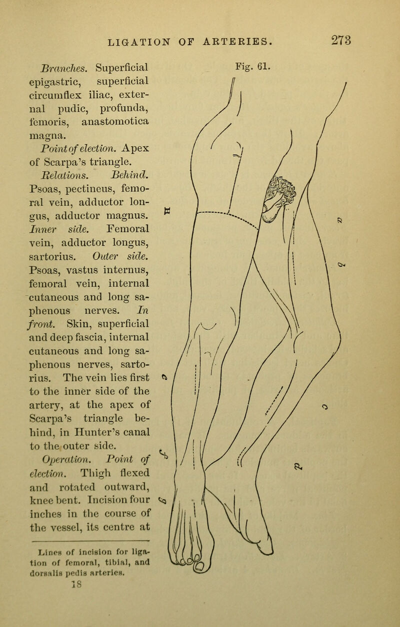 Branches. Superficial epigastric, superficial circumflex iliac, exter- nal pudic, profunda, femoris, anastomotica magna. Point of election. Apex of Scarpa's triangle. Belations. Behind. Psoas, pectineus, femo- ral vein, adductor lon- gus, adductor magnus. ^ Inner side. Femoral vein, adductor longus, Psoas, vastus internus, femoral vein, internal cutaneous and long sa- phenous nerves. In front. Skin, superficial and deep fascia, internal cutaneous and long sa- phenous nerves, sarto- rius. The vein lies first f5> to the inner side of the artery, at the apex of Scarpa's triangle he- hind, in Hunter's canal to the outer side. Operation. Point of ^ election. Thigh flexed and rotated outward, knee bent. Incisifmfour ^ inches in the course of the vessel, its centre at L.ineB of incision for liga- tion of femoral, tibial, and dorsallfl peclia arteries. IS Fig. 61.
