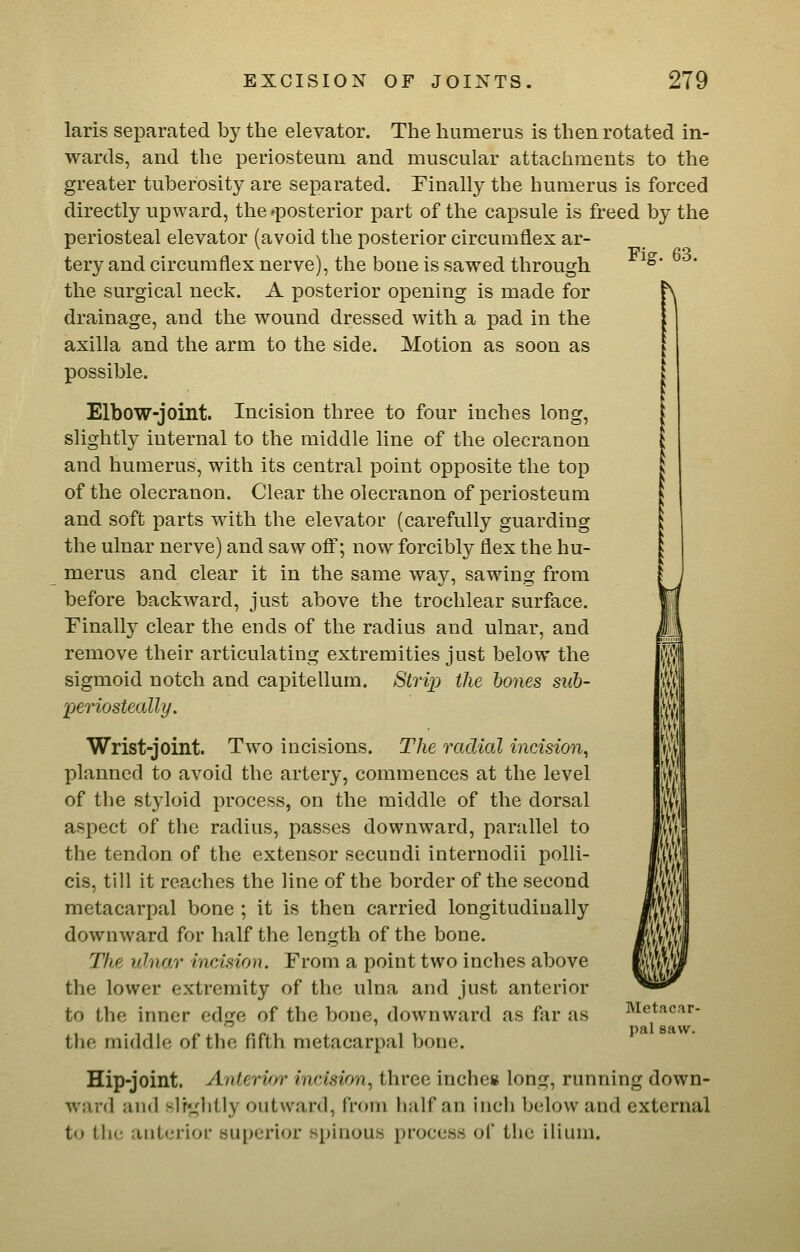 Fig. 63. laris separated by the elevator. The humerus is then rotated in- wards, and the periosteum and muscular attachments to the greater tuberosity are separated. Finally the humerus is forced directly upward, the ^posterior part of the capsule is freed by the periosteal elevator (avoid the posterior circumflex ar- tery and circumflex nerve), the bone is sawed through the surgical neck. A posterior opening is made for drainage, and the wound dressed with a pad in the axilla and the arm to the side. Motion as soon as possible. Elbow-joint. Incision three to four inches long, slightly internal to the middle line of the olecranon and humerus, with its central point opposite the top of the olecranon. Clear the olecranon of periosteum and soft parts with the elevator (carefully guarding the ulnar nerve) and saw off; now forcibly flex the hu- merus and clear it in the same way, sawing from before backward, just above the trochlear surface. Finally clear the ends of the radius and ulnar, and remove their articulating extremities just below the sigmoid notch and capitellum. Stri}) the hones sitb- 'periosteally. m m m f i M Wrist-joint. Two incisions. The radial incision^ planned to avoid the artery, commences at the level of the styloid process, on the middle of the dorsal aspect of the radius, passes downward, parallel to the tendon of the extensor secundi internodii poUi- cis, till it reaches the line of the border of the second metacarpal bone ; it is then carried longitudinally downward for half the length of the bone. The ulnar incAsion. From a point two inches above the lower extremity of the ulna and just anterior to the inner edge of the bone, downward as far as Metacar- tho middle of the fifth metacarpal bone. Hip-joint. Anterir/r incAsion, three inches long, running down- ward and slrglitly outward, from half an incli below and external to the anterior superior spinous process of the ilium.