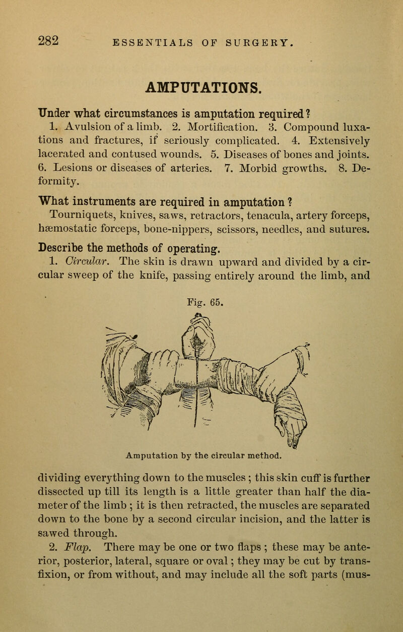 AMPUTATIONS. Under what circumstances is amputation required ? 1. Avulsion of a limb. 2. Mortification. 3. Compound luxa- tions and fractures, if seriously complicated. 4. Extensively lacerated and contused wounds. 5. Diseases of bones and joints. 6. Lesions or diseases of arteries. 7. Morbid growths. 8. De- formity. What instruments are required in amputation ? Tourniquets, knives, saws, retractors, tenacula, artery forceps, haemostatic forceps, bone-nippers, scissors, needles, and sutures. Describe the methods of operating^. 1. Circular. The skin is drawn upward and divided by a cir- cular sweep of the knife, passing entirely around the limb, and Amputation by the circular method. dividing everything down to the muscles ; this skin cuff is further dissected up till its length is a little greater than half the dia- meter of the limb ; it is then retracted, the muscles are separated down to the bone by a second circular incision, and the latter is sawed through. 2. Flap. There maj'^ be one or two flaps ; these may be ante- rior, posterior, lateral, square or oval; they may be cut by trans- fixion, or from without, and may include all the soft parts (mus-