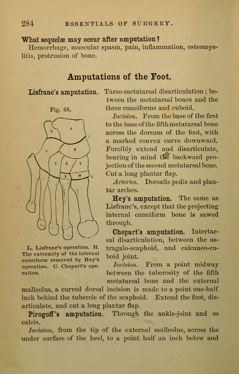 What sequelae may occur after amputation? Hemorrhage, muscular spasm, pain, inflammation, osteomye- litis, protrusion of bone. Amputations of the Foot. Lisfranc's amputation. Fig. 68. Tarso-metatarsal disarticulation; be- tween the metatarsal bones and the three cuneiforms and cuboid. Incision. From the base of the first to the base of the fifth metatarsal bone across the dorsum of the foot, with a marked convex curve downward. Forcibly extend and disarticulate, bearing in mind the backward pro- jection of the second metatarsal bone. Cut a long plantar flap. Arteries. Dorsalis pedis and plan- tar arches. Hey's amputation. The same as Lisfranc's, except that the projecting internal cuneiform bone is sawed through. Chopart's amputation. Intertar- sal disarticulation, between the as- tragalo-scaphoid, and calcaneo-cu- boid joint. Incision. From a point midway between the tuberosity of the fifth metatarsal bone and the external malleolus, a curved dorsal incision is made to a point one-half inch behind the tubercle of the scaphoid. Extend the foot, dis- articulate, and cut a long plantar flap. Pirogoff's amputation. Through the ankle-joint and os calcis. Incision., from the tip of the external malleolus, across the under surface of the heel, to a point half an inch below and li. Lisfranc's operation. H. The extremity of the internal cuneiform removed by Hey's operation. C. Chopart's ope- ration.