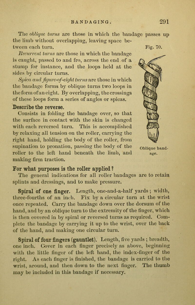 Fig. 70. The oblique turns are those in which the bandage passes up the limb witliout overlapping, leaving space be- tween each turn. Becurrent turns are those in which the bandage is caught, passed to and fro, across the end of a stump for instance, and the loops held at the sides by circular turns. Spica and figure-of-eight turns are those in which the bandage forms by oblique turns two loops in the form of an eight. By overlapping, the crossings of these loops form a series of angles or spicas. Describe the reverse. Consists in folding the bandage over, so that the surface in contact with the skin is changed with each reversed turn. This is accomplished by relaxing all tension on the roller, carrying the right hand, holding the body of the roller, from supination to pronation, passing the body of the roller to the left hand beneath the hmb, and makins: firm traction. Oblique band- age. For what purposes is the roller applied ? The general indications for all roller bandages are to retain splints and dressings, and to make pressure. Spiral of one finger. Length, one-and-a-half yards ; width, three-fourths of an inch. Fix by a circular turn at the wrist once repeated. Carry the bandage down over the dorsum of the hand, and by an oblique turn to the extremity of the finger, which is then covered in by spiral or reversed turns as required. Com- plete the bandage by carrying it up to the wrist, over the back of the hand, and making one circular turn. Spiral of four fingers (gauntlet). Length, five yards ; breadth, one inch. Cover in each finger precisely as above, beginning with the little finger of the left hand, the index-finger of the right. As each finger is finished, the bandage is carried to the wrist, around, and then down to the next finger. The thumb may be included in this bandage if necessary.