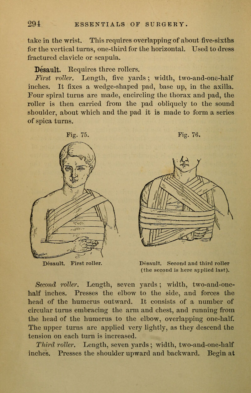 take in the wrist. This requires overlapping of about five-sixths for the vertical turns, one-third for the horizontal. Used to dress fractured clavicle or scapula. Desault. Requires three rollers. First roller. Length, five yards; width, two-and-one-half inches. It fixes a wedge-shaped pad, base up, in the axilla. Four spiral turns are made, encircling the thorax and pad, the roller is then carried from the pad obliquely to the sound shoulder, about which and the pad it is made to form a series of spica turns. Fig. 75. Fig. 76. Desault. First roller. Desault, Second and third roller (the second is here applied last). Second roller. Length, seven yards; width, two-and-one- half inches. Presses the elbow to the side, and forces the head of the humerus outward. It consists of a number of circular turns embracing the arm and chest, and running from the head of the humerus to the elbow, overlapping one-half. The upper turns are applied very lightly, as they descend the tension on each turn is increased. Third roller. Length, seven yards ; width, two-and-one-half inches. Presses the shoulder upward and backward. Begin at
