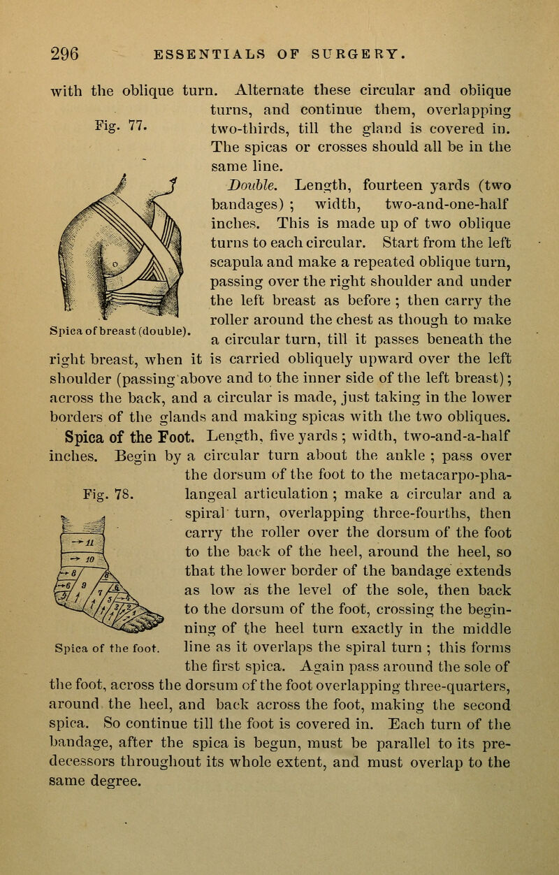 Spica of breast (double). with the oblique turn. Alternate these circular and oblique turns, and continue them, overlapping ^ig- 77. two-thirds, till the gland is covered in. The spicas or crosses should all be in the same line. Double. Lensjth, fourteen yards (two bandages) ; width, two-and-one-half inches. This is made up of two oblique turns to each circular. Start from the left scapula and make a repeated oblique turn, passing over the right shoulder and under the left breast as before ; then carry the roller around the chest as though to make a circular turn, till it passes beneath the right breast, when it is carried obliquely upward over the left shoulder (passing above and to the inner side of the left breast); across the back, and a circular is made, just taking in the lower borders of the glands and making spicas with the two obliques. Spica of the Foot. Length, five yards ; width, two-and-a-half inches. Begin by a circular turn about the ankle ; pass over the dorsum of the foot to the metacarpo-pha- Fig. 78. langeal articulation ; make a circular and a ^ ^ spiral turn, overlapping three-fourths, then p—^ carry the roller over the dorsum of the foot to the back of the heel, around the heel, so that the lower border of the bandage extends as low as the level of the sole, then back to the dorsum of the foot, crossing the begin- ning of the heel turn exactly in the middle line as it overlaps the spiral turn ; this forms the first spica. Again pass around the sole of the foot, across the dorsum of the foot overlapping three-quarters, around the heel, and back across the foot, making the second spica. So continue till the foot is covered in. Each turn of the bandage, after the spica is begun, must be parallel to its pre- decessors throughout its whole extent, and must overlap to the same degree. Spica of the foot.