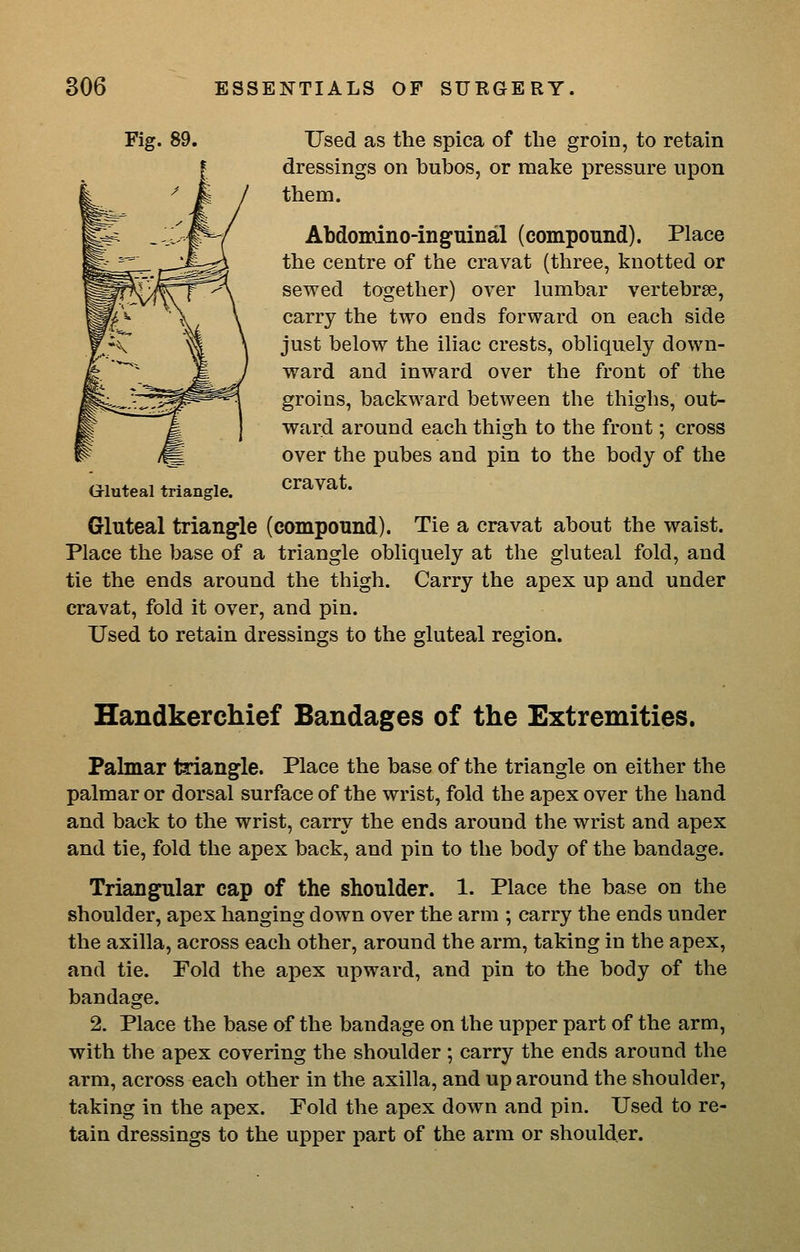 Fig. 89. Used as the spica of the groin, to retain dressings on bubos, or make pressure upon them. Abdomino-inguinal (compound). Place the centre of the cravat (three, knotted or sewed together) over lumbar vertebrse, carry the two ends forward on each side just below the iliac crests, obliquely down- ward and inward over the front of the groins, backward between the thighs, out- ward around each thigh to the front; cross over the pubes and pin to the body of the Gluteal triangle. cravat. Gluteal triangle (compound). Tie a cravat about the waist. Place the base of a triangle obliquely at the gluteal fold, and tie the ends around the thigh. Carry the apex up and under cravat, fold it over, and pin. Used to retain dressings to the gluteal region. Handkerchief Bandages of the Extremities. Palmar triangle. Place the base of the triangle on either the palmar or dorsal surface of the wrist, fold the apex over the hand and back to the wrist, carry the ends around the wrist and apex and tie, fold the apex back, and pin to the body of the bandage. Triang^ilar cap of the shoulder. 1. Place the base on the shoulder, apex hanging down over the arm ; carry the ends under the axilla, across each other, around the arm, taking in the apex, and tie. Fold the apex upward, and pin to the body of the bandage. 2. Place the base of the bandage on the upper part of the arm, with the apex covering the shoulder; carry the ends around the arm, across each other in the axilla, and up around the shoulder, taking in the apex. Fold the apex down and pin. Used to re- tain dressings to the upper part of the arm or shoulder.