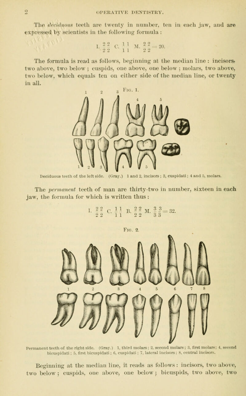 ()Pr,RATIVK DENTISTRY. The (IrciditoKs teetli are twenty in number, ten in each jaw, and are expressed by scientists in the fuHowing fornuda : I. - - C. ' ' M. - - - 20. 2 2 11 2 2 The formula is read as follows, beginning at the median line : incisors? two above, two below ; cuspids, one above, one below ; molars, two above, two below, which equals teu on either side of the median line, or twenty in all. Fic. 1. 1 ' 2 ^ 3 \1 II 4 Deciduous teeth of the left side. (Gray.) 1 and 2, incisors ; 3, cuspidati; 4 and 5, molars. The permanent teeth of man are thirty-two in number, sixteen in each jaw, the formula for which is written thus : I. 22 c 11 B. 22 m. 3 3^32. 22 11 2 2 33 Fig. 2. Permanent teeth of the right side. (Gray.) 1, third molars ; 2, second molars ; 3, first molars; 4, second bicuspidati ; 5, first bicuspidati; 6, cuspidati; 7, lateral incisors; H, central inci.sore. Beginning at the median line, it reads as follows: incisors, two above, two below ; cuspids, one abov^e, one below 5 bicuspids, two above, two