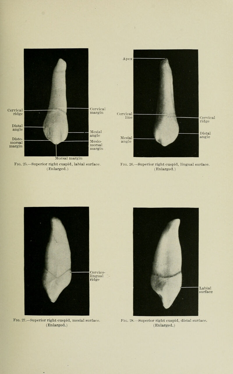 Apex Cervical margin Cervical line Mesial angle Mesio- morsal Mesial angle margin Morsal margin Fig. 25.—Superior right cuspid, labial surface. (Enlarged.) Fig. 26. -Superior right cuspid, lingual surface. (Enlarged.) Fig. 27.—Superior right cuspid, mesial surface. -Superior right cuspid, distal surface.