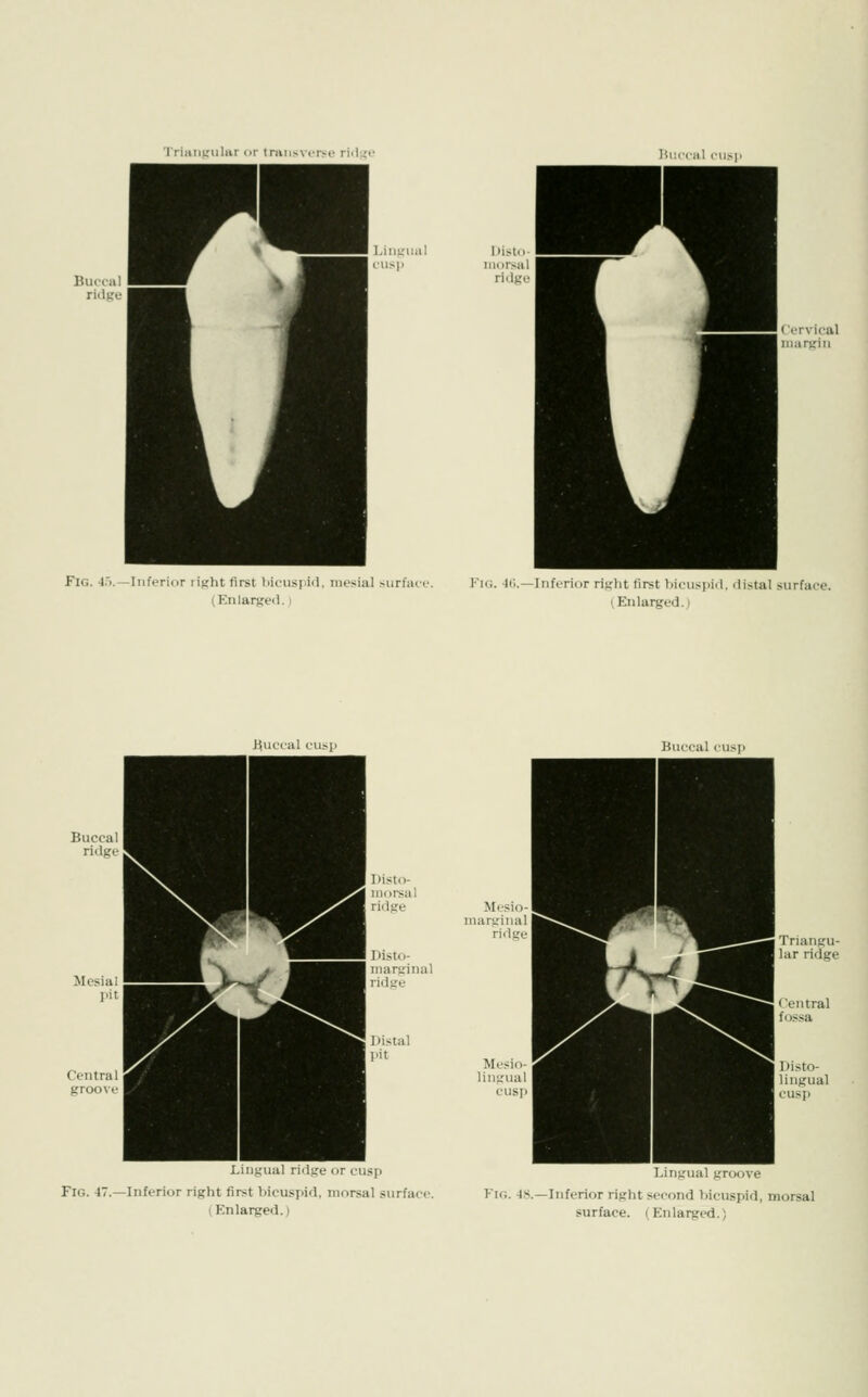 TriHiitrnliir or Inn is verso riil'.:i Hi:cciil r\i>\i l.iiiKiiiil Dislu- rusp iiiorsal Fig. 45.—Inferior liffht first bicuspid, mesial surfa (Enlargeil.» Fig. -lii.—Inferior risht first bicuspid, distal surface. (Enlarged.; Huccal cusp Buccal cusi) Bucca inarjiinal Lingual ridge or cusp Fig. i~.—Inferior right first bicuspid, niorsal surface. (Enlarged.) Mesi liufiual Lingual groove Fig. -18.—Inferior right second bicuspid, morsal surface. (En larged.)