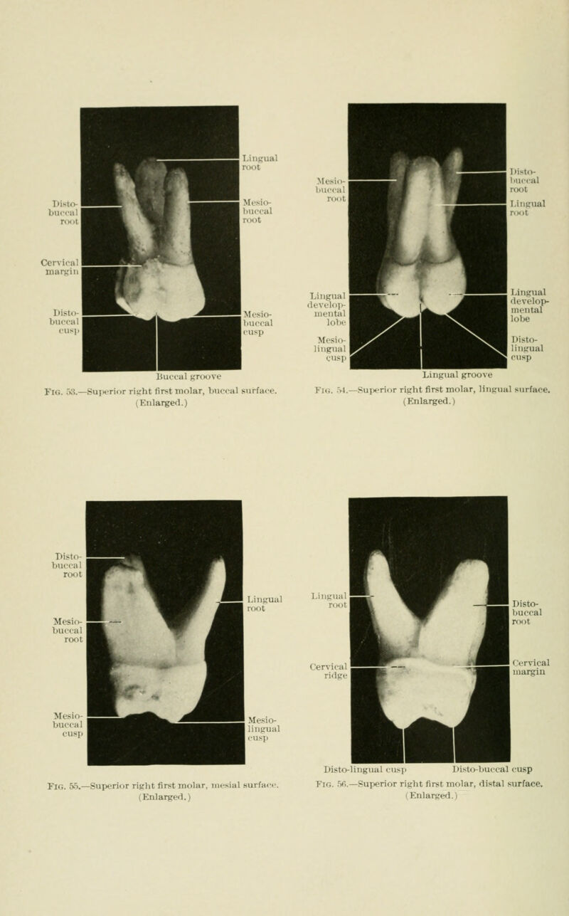 Mcsio- huccal cusp lUiccal grcMjve Fig. 53.—Sui>tTior risrht first molar, buccal surface. (Enlarged.) Lingual <k'Vcli>i Liiifjual groove Fk;. .M.—Superior right first molar, lingual surface. (Enlarged.) Lingual Mesio bucca cusj Me.«io- FlG. 5.5.—Superif)r right first molar, mesial surface. Disto-liiigual cu>ii l)isl<)-l)uccal cusp Fig. .ifi.—Superior right first molar, distal s\irface.