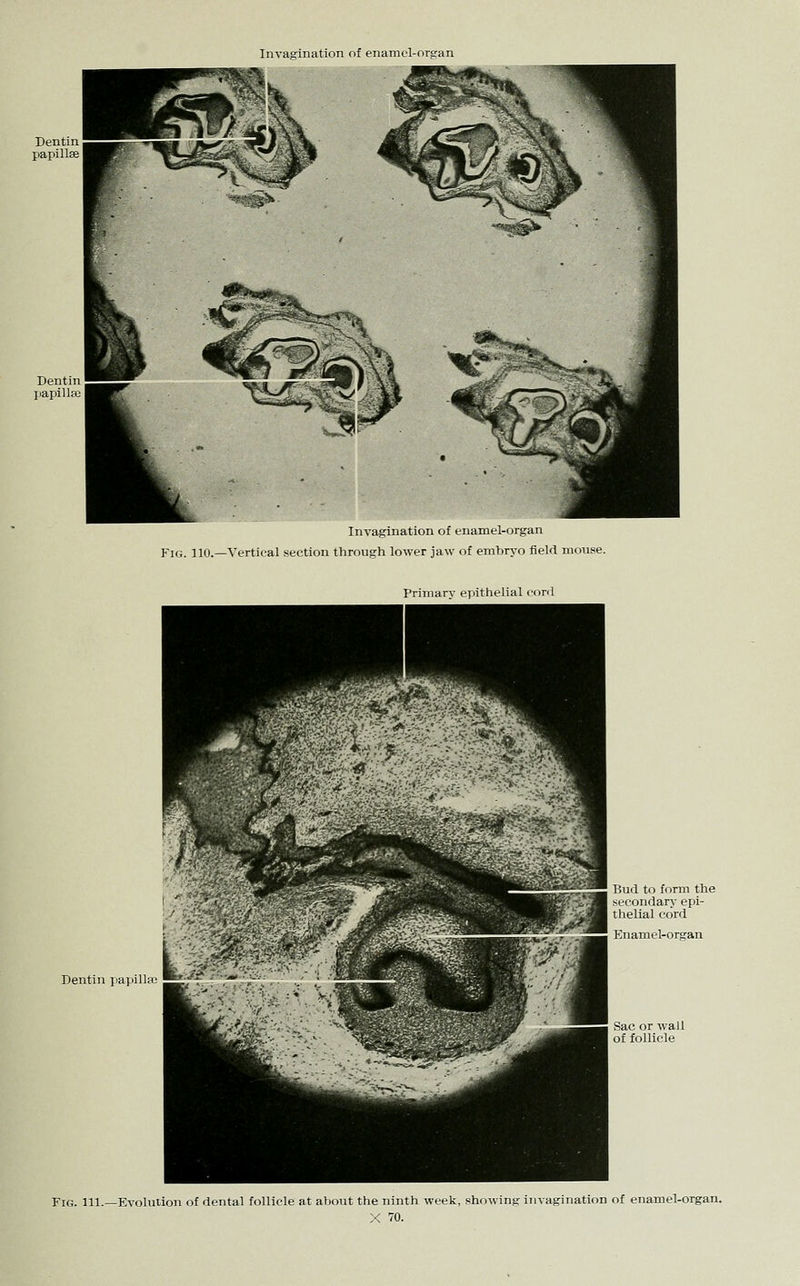 Invagination of enamol-organ Dentin papillse Invagination of enamel-organ Fig. 110.—Vertical section through lower jaw of embryo fielrl mouse. Primary epithelial conl Dentin papilla} Bud to form the secondary epi- thelial cord Enamel-organ Fig. 111.—Evolution of dental follicle at about the ninth week, showing invagination of enamel-organ. X 70.