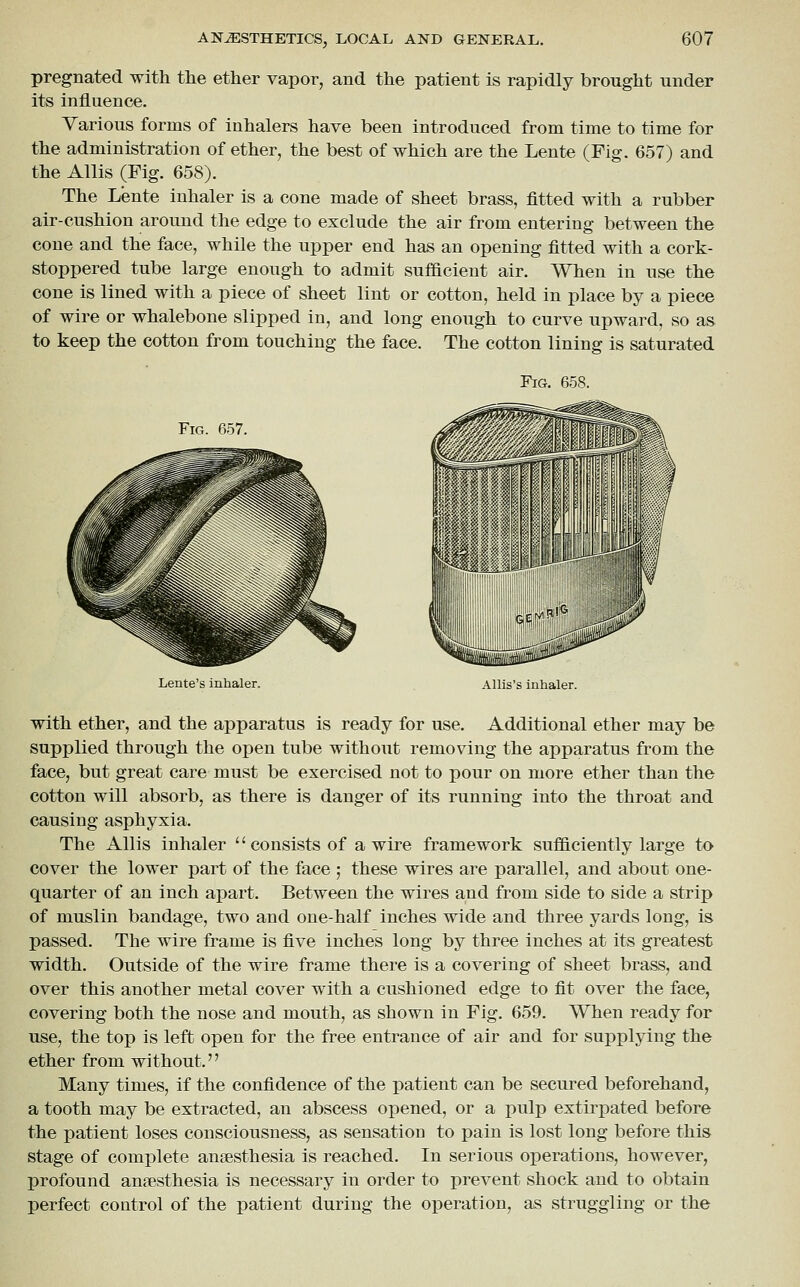 pregnated with the ether vapor, and the patient is rapidly brought under its influence. Various forms of inhalers have been introduced from time to time for the administration of ether, the best of which are the Lente (Fig. 657) and the Allis (Fig. 658). The Lente inhaler is a cone made of sheet brass, fitted with a rubber air-cushion around the edge to exclude the air from entering between the cone and the face, while the upper end has an opening fitted with a cork- stoppered tube large enough to admit sufBcient air. When in use the cone is lined with a piece of sheet lint or cotton, held in place by a piece of wire or whalebone slipped in, and long enough to curve upward, so as to keep the cotton from touching the face. The cotton lining is saturated Fig. 658. Fig. 657. Lente's inhaler. Allis's inhaler. with ether, and the apparatus is ready for use. Additional ether may be supplied through the open tube without removing the apparatus from the face, but great care must be exercised not to pour on more ether than the cotton will absorb, as there is danger of its running into the throat and causing asphyxia. The Allis inhaler '' consists of a wire framework sufficiently large to cover the lower part of the face ; these wires are parallel, and about one- quarter of an inch apart. Between the wires and from side to side a strip of muslin bandage, two and one-half inches wide and three yards long, is passed. The wire frame is five inches long by three inches at its greatest width. Outside of the wire frame there is a covering of sheet brass, and over this another metal cover with a cushioned edge to fit over the face, covering both the nose and mouth, as shown in Fig. 659. When ready for use, the top is left open for the free entrance of air and for supplying the ether from without. Many times, if the confidence of the patient can be secured beforehand, a tooth may be extracted, an abscess opened, or a pulp extirpated before the patient loses consciousness, as sensation to pain is lost long before this stage of complete anaesthesia is reached. In serious operations, however, profound anaesthesia is necessary in order to prevent shock and to obtain perfect control of the patient during the operation, as struggling or the