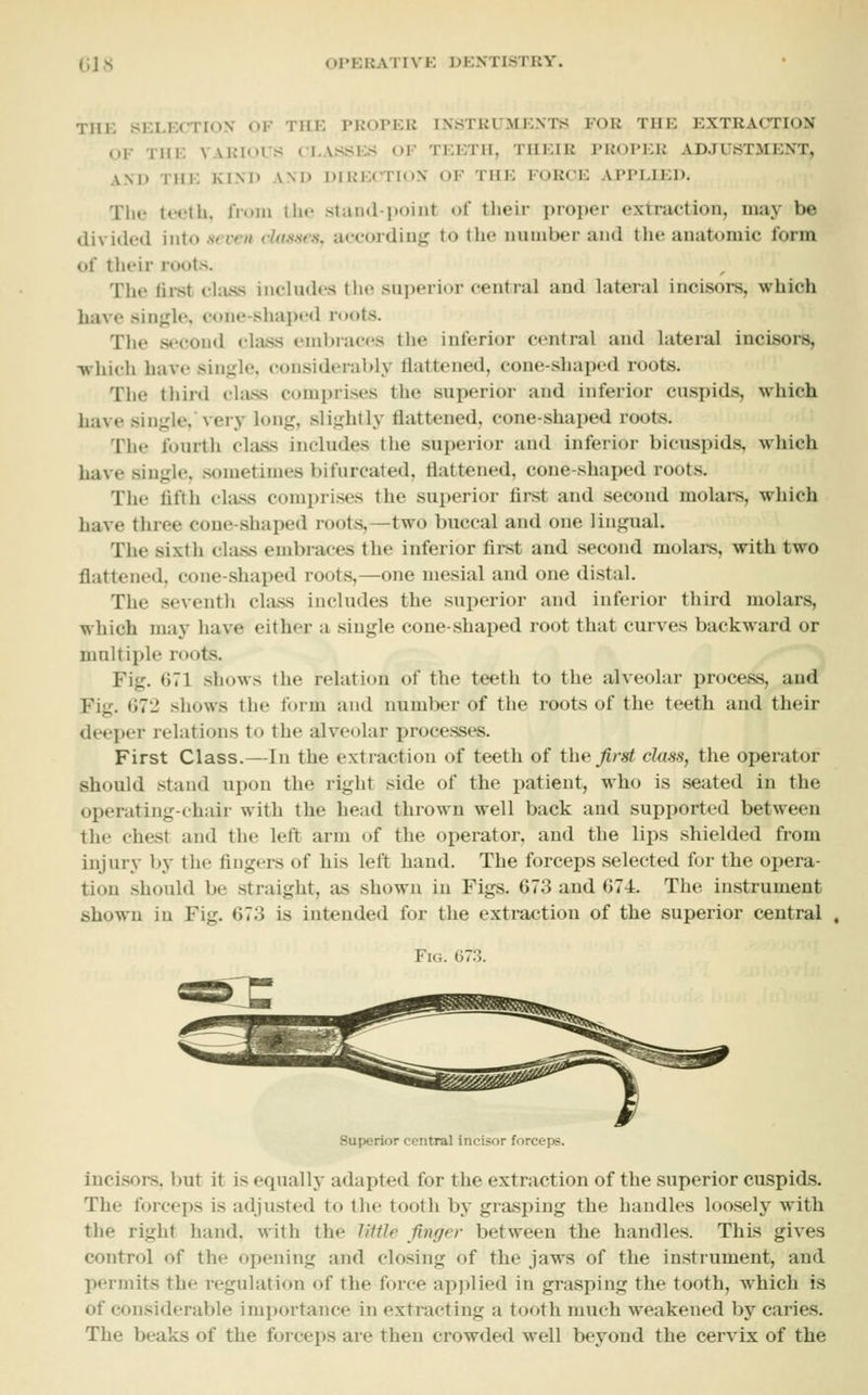 THE SELECTION OF rilK PKOPER INSTKUMEXTS FOR THE EXTRACTION OF THE VARIors CLASSES OF TEETH, THEIR PROPER ADJUSTMENT, AM) THE KIM) AM) DIRECTION OF THE FORCE APPLIED. The teeth, from the staiid-point of their proper extruetion, may be divided into .scvm cl((.s.scs, aceordiuj; to tlie number and the anatomic form of their roots. The fii-st ehuss inehuh'S the superior eentral and lateral inci.sors, which have single, cone-shaped roots. The second class embraces the inferior central and lateral incisors, -which have single, considerably flattened, cone-shaped roots. The third chuss comprises the superior and inferior cuspids, which have single,'very long, slightly flattened, cone-shaped roots. The fourth chiss includes the superior and inferior bicuspids, which have single, .sometimes bifurcated, flattened, cone-shaped roots. The flfth class comprises the superior first and second molars, which have three cone-shaped roots,—two buccal and one lingual. The sixth class embraces the inferior first and second molars, with two flattened, cone-shaped roots,—one mesial and one distal. The seventh class includes the sui^erior and inferior third molars, which may have either a single cone-shaped root that curves backward or multiple roots. Fig. G71 shows the relation of the teeth to the alveolar process, and Fig. 072 shows the form and number of the roots of the teeth and their deeper relations to the alveolar processes. First Class.—In the extraction of teeth of the first class, the operator should stand upon the right side of the patient, who is seated in the operating-chair with the head thrown well back and supported between the chest and the left arm of the operator, and the lips shielded from injury by the fingers of his left hand. The forceps selected for the opera- tion should be straight, liS shown in Figs. 673 and 674. The instrument shown in Fig. 673 is intended for the extraction of the superior central , Fig. G73. Superior central incisor forceps. incisors, but it is equally adapted for the extraction of the superior cuspids. The forceps is adjusted to the tooth by grasping the handles loosely with the right hand, with the Utile finger between the handles. This gives control of the opening and closing of the jaws of the instrument, and permits the regulation of the force applied in grasping the tooth, which is of considerable importance in extracting a tooth much weakened by caries. The beaks of the forceps are then crowded well bej^ond the cervix of the