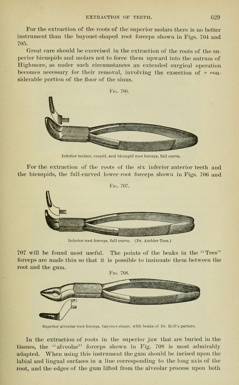 For the extraction of the roots of the superior molars there is no better instrument than the bayonet-shaped root forceps shown in Figs. 704 and 705. Great care should be exercised in the extraction of the roots of the su- perior bicuspids and molars not to force them upward into the antrum of Highmore, as under such circumstances an extended surgical operation becomes necessary for their removal, involving the exsection of p f^on- siderable portion of the floor of the sinus. Fig. 706. Inferior incisor, cuspid, and bicuspid root forceijs, full curve. For the extraction of the roots of the six inferior anterior teeth and the bicuspids, the full-curved lower-root forceps shown in Figs. 706 and Fig. 707. Inferior root forceps, full curve. (Dr. Ambler Tees.) 707 will be found most useful. The points of the beaks in the Tees forceps are made thin so that it is possible to insinuate them between the root and the gum. Fig. 708. Superior alveolar root forceps, bayonet shape, with beaks of Dr. Kell's pattern. In the extraction of roots in the superior jaw that are buried in the tissues, the ''alveolar forceps shown in Fig. 708 is most admirably adapted. When using this instrument the gum should be incised upon the labial and lingual surfaces in a line corresponding to the long axis of the root, and the edges of the gum lifted from the alveolar process upon both