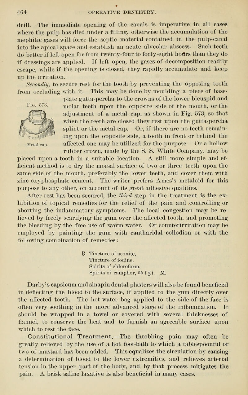 drill. The immediate opening of the canals is imperative in all cases where the pulp has died under a filling, otherwise the accumulation of the mephitic gases will force the septic material contained in the pulp-canal into the apical space and establish an acute alveolar abscess. Such teeth do better if left open for from twenty-four to forty-eight hoflrs than they do if dressings are applied. If left open, the gases of decomposition readily escape, while if the opening is closed, they rapidly accumulate and keep up the irritation. Secondly, to secure rest for the tooth by preventing the opposing tooth from occluding with it. This may be done by moulding a piece of base- plate gutta-xDcrcha to the crowns of the lower bicuspid and Fig. 573. molar teeth upon the opposite side of the mouth, or the adjustment of a metal cap, as shown in Fig. 573, so that when the teeth are closed they rest upon the gutta-percha splint or the metal cap. Or, if there are no teeth remain- ing upon the opposite side, a tooth in front or behind the Metal cap. affcctcd One may be utilized for the purpose. Or a hollow rubber crown, made by the S. S. White Company, may be placed ux)on a tooth in a suitable location. A still more simple and ef- ficient method is to dry the morsal surface of two or three teeth upon the same side of the mouth, preferably the lower teeth, and cover them with zinc oxyphosphate cement. The writer prefers Ames's metaloid for this purpose to any other, on account of its great adhesive qualities. After rest has been secured, the third step in the treatment is the ex- hibition of topical remedies for the relief of the pain and -controlling or aborting the inflammatory symptoms. The local congestion may be re- lieved by freely scarifying the gum over the affected tooth, and promoting the bleeding by the free use of warm water. Or counterirritation may be employed by painting the gum with cantharidal collodion or with the following combination of remedies : R Tincture of aconite, Tincture of iodine, Spirits of chloroform, Spirits of camphor, aa f 3 i. M. Darby's capsicum and sinapin dental plasters will also be found beneficial in deflecting the blood to the surface, if applied to the gum directly over the affected tooth. The hot-water bag applied to the side of the face is often very soothing in the more advanced stage of the inflammation. It should be wrapped in a towel or covered with several thicknesses of flannel, to conserve the heat and to furnish an agreeable surface upon which to rest the face. Constitutional Treatment.—The throbbing pain may often be greatly relieved by the use of a hot foot-bath to which a tablespoonful or two of mustard has been added. This equalizes the circulation hy causing a determination of blood to the lower extremities, and relieves arterial tension in the upper part of the body, and by that process mitigates the pain. A brisk saline laxative is also beneficial in many cases.