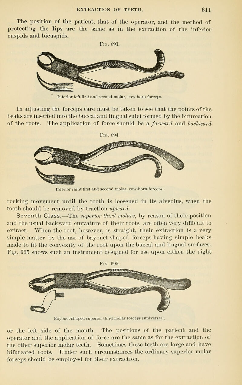 The position of the patient, that of the operator, and the method of protecting the lips are the same as in the extraction of the inferior cuspids and bicuspids. Fig. 693. Inferior left first and second molar, cow-horn forceps. In adjusting the forceps care must be taken to see that the points of the beaks are inserted into the buccal and lingual sulci formed by the bifurcation of the roots. The application of force should be a forward and backward Fig, 694. Inferior right first and second molar, cow-horn forceps. rocking movement until the tooth is loosened in its alveolus, when the tooth should be removed by traction upivard. Seventh Class.—The superior third molars, by reason of their position and the usual backward curvature of their roots, are often very difficult to extract. When the root, however, is straight, their extraction is a very simple matter by the use of bayonet-shaped forceps having simple beaks made to fit the convexity of the root upon the buccal and lingual surfaces. Fig. 695 shows such an instrument designed for use upon either the right Fig. 695. Bayonet-shaped superior third molar forceps (universal). or the left side of the mouth. The positions of the patient and the operator and the application of force are the same as for the extraction of the other superior molar teeth. Sometimes these teeth are large and have bifurcated roots. Under such circumstances the ordinary superior molar forceps should be employed for their extraction.