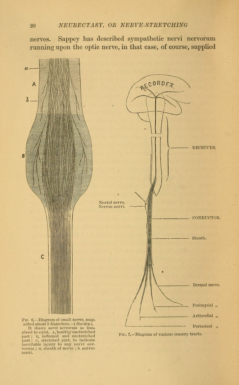 nerves. Sappey has described sympathetic nervi nervorum running upon the optic nerve, in that case, of course, supplied Neural nerve. Nervus iiervi. Fio 6.—Diagram of small nerve, mag. nified about 5 diameters.—{Horsley). It shows nervi nenmrum as ima- pinefl to exist. A,healthy unstretcheJ part; b, inflamerl and unstretcbed part: (j, stretched part, to indicate inevitable injury to any nervi ner- vonini ; a, slieath of nerve ; h. nervus nervi. RECEIVER. CONDUCTOR. Sheath. Dermal nerve. Perimysial „ Arthrodial „ Periosteal „ Fifi. 7,—Diagram of various sensory tracts.