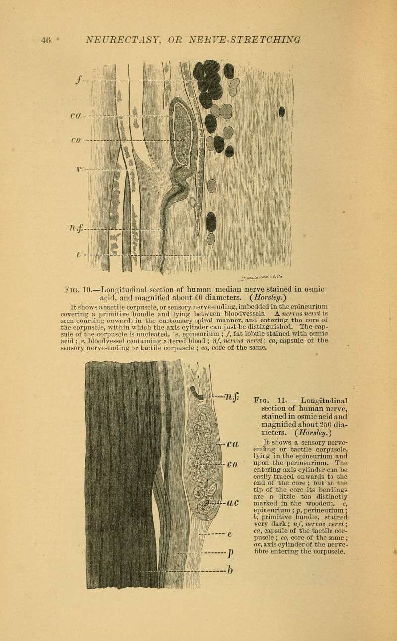 ^■l^7;«Wi Fig. 10.—Longitudinal section of human median nerve stained in osmic acid, and magnified about 60 diameters. {Horsley.') It shows a tactile corpuscle, or sensory nerve-ending, imbedded in the epineurium covering a primitive bundle and lying between bloodvessels. A nervus nervi is seen coursing onwards in the customary spiral manner, and entering the core of the corpuscle, within which the axis cylinder can just be distinguished. The cap- sule of the corpuscle is nucleated, e, epineurium ; /, fat lobule stained with osmic acid ; v, bloodvessel containing altered blood ; nf, nerriis nervi; ca, capsule of the sensory nerve-ending or tactile corpuscle ; co, core of the same. s-ca Fig. 11. — Longitudinal section of human nerve, stained in osmic acid and magnified about 250 dia- meters. (Horsley.) It shows a sensory nerve- ending or tactile coi'puscle, lying in the epineurium and upon the perineurium. The entering axis cylinder can be easily traced onwards to the end of the core ; but at the tip of the core its bondings are a little too distinctly marked in the woodcut, e, epineurium ; p, perineurium; 6, primitive bundle, stained very dark; nf, nervus nervi; ca, capsule of the tactile cor- puscle ; CO, core of the same ; ac, axis cylinder of the nerve- fibre entering the corpuscle.