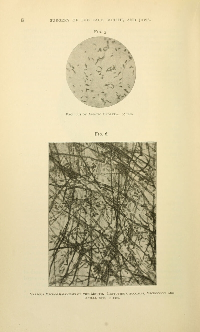 Fig. 5- i-^ ' S Bacillus of Asiatic Cholera. X 1200. Fig. 6. Various Micro-OrgaxNISms of the Mouth. Leptothri-x buccalis, Micrococci and Bacilli, etc. X 1200.