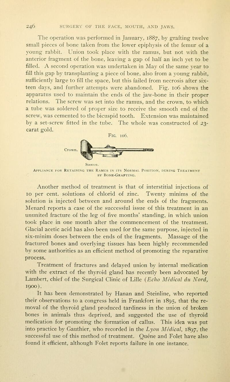 The Operation was performed in January, 1887, by grafting twelve small pieces of bone taken from the lower epiphysis of the femur of a young rabbit. Union took place with the ramus, but not with the anterior fragment of the bone, leaving a gap of half an inch yet to be filled. A second operation was undertaken in May of the same year to fill this gap by transplanting a piece of bone, also from a young rabbit, sufficiently large to fill the space, but this failed from necrosis after six- teen days, and further attempts were abandoned. Fig. 106 shows the apparatus used to maintain the ends of the jaw-bone in their proper relations. The screw was set into the ramus, and the crown, to which a tube was soldered of proper size to receive the smooth end of the screw, was cemented to the bicuspid tooth. Extension was maintained by a set-screw fitted in the tube. The whole was constructed of 23- carat gold. Fig. 106. Crown. Sleeve. Appliance for Retaining the Ramus in its Normal Position, during Treatment BY Bone-Grafting. Another method of treatment is that of interstitial injections of 10 per cent, solutions of chlorid of zinc. Twenty minims of the solution is injected between and around the ends of the fragments. Menard reports a case of the successful issue of this treatment in an ununited fracture of the leg of five months' standing, in which union took place in one month after the commencement of the treatment. Glacial acetic acid has also been used for the same purpose, injected in six-minim doses between the ends of the fragments. Massage of the fractured bones and overlying tissues has been highly recommended by some authorities as an efficient method of promoting the reparative process. Treatment of fractures and delayed union by internal medication with the extract of the thyroid gland has recently been advocated by Lambert, chief of the Surgical Clinic of Lille {Echo Medical du Nord, 1900). It has been demonstrated by Hanan and Steinline, who reported their observations to a congress held in Frankfort in 1895, that the re- moval of the thyroid gland produced tardiness in the union of broken bones in animals thus deprived, and suggested the use of thyroid medication for promoting the formation of callus. This idea was put into practice by Gauthier, who recorded in the Lyon Medical, 1897, the successful use of this method of treatment. Queue and Folet have also found it efficient, although Folet reports failure in one instance.