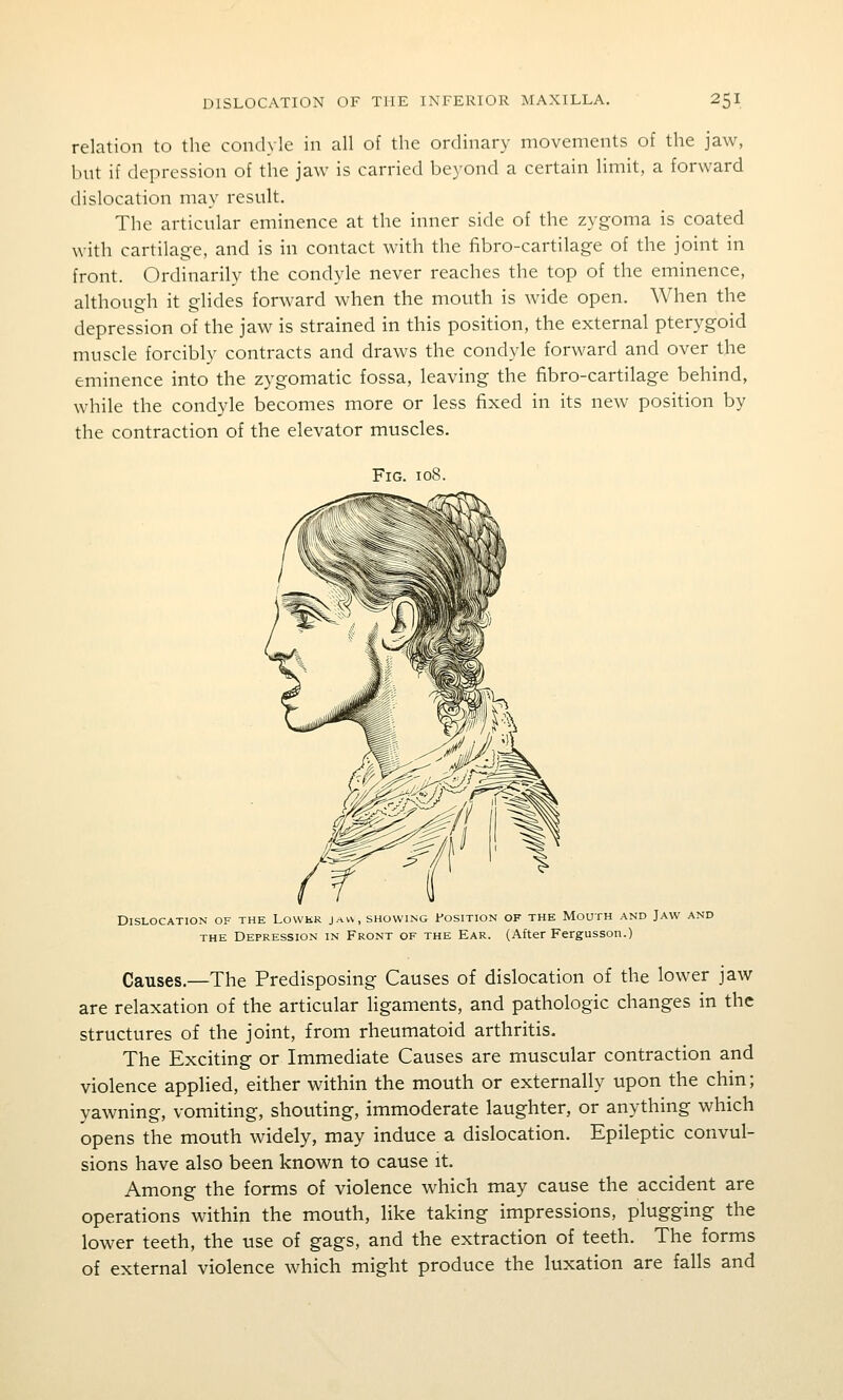 relation to the condyle in all of the ordinary movements of the jaw, but if depression of the jaw is carried beyond a certain limit, a forward dislocation may result. The articular eminence at the inner side of the zygoma is coated with cartilag-e, and is in contact with the fibro-cartilage of the joint in front. Ordinarily the condyle never reaches the top of the eminence, although it glides forward when the mouth is wide open. When the depression of the jaw is strained in this position, the external pterygoid muscle forcibly contracts and draws the condyle forward and over the eminence into the zygomatic fossa, leaving the fibro-cartilage behind, while the condyle becomes more or less fixed in its new position by the contraction of the elevator muscles. Fig. 108. Dislocation of the Lovvkr j.aw, showing Position of the Mouth and Jaw and THE Depression in Front of the Ear. (After Fergusson.) Causes.—The Predisposing Causes of dislocation of the lower jaw are relaxation of the articular ligaments, and pathologic changes in the structures of the joint, from rheumatoid arthritis. The Exciting or Immediate Causes are muscular contraction and violence applied, either within the mouth or externally upon the chin; yawning, vomiting, shouting, immoderate laughter, or anything which opens the mouth widely, may induce a dislocation. Epileptic convul- sions have also been known to cause it. Among the forms of violence which may cause the accident are operations within the mouth, like taking impressions, plugging the lower teeth, the use of gags, and the extraction of teeth. The forms of external violence which might produce the luxation are falls and