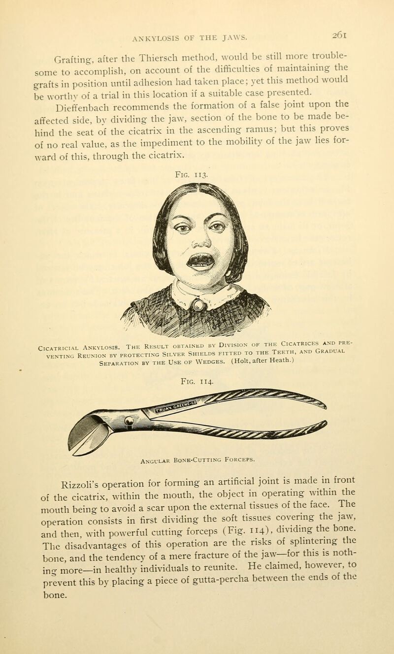 Grafting, after the Thiersch method, would be still more trouble- some to aca)mplish, on account of the difficulties of maintaining the grafts in position until adhesion had taken place; yet this method would be worthy of a trial in this location if a suitable case presented. Dieffenbach recommends the formation of a false joint upon the affected side, bv dividing the jaw, section of the bone to be made be- hind the seat of the cicatrix in the ascending ramus; but this proves of no real value, as the impediment to the mobility of the jaw lies for- ward of this, through the cicatrix. Fig. 113. CICATRICIAL ANKYLOSIS. THE RESULT OBTAINED BV DlVSIOX OE THE ^ll-^^l^^l^;;;/^^''- VENTiNG Reunion by protecting Silver Shields fitted to the Teeth, and Gradual Separation by the Use of Wedges. (Holt, after Heath.) Fig. 114. Angular Bone-Cutting Forceps. Rizzoli's operation for forming an artificial joint is made in front of the cicatrix, within the mouth, the object in operating within the mouth being to avoid a scar upon the external tissues of the face. The operation consists in first dividing the soft tissues covermg the jaw, and then, with powerful cutting forceps (Fig. 114), dividing the bone. The disadvantages of this operation are the risks of sphntering the bone, and the tendency of a mere fracture of the jaw—for this is noth- in- more-in healthv individuals to reunite. He claimed, however, to prevent this by placing a piece of gutta-percha between the ends of the bone.