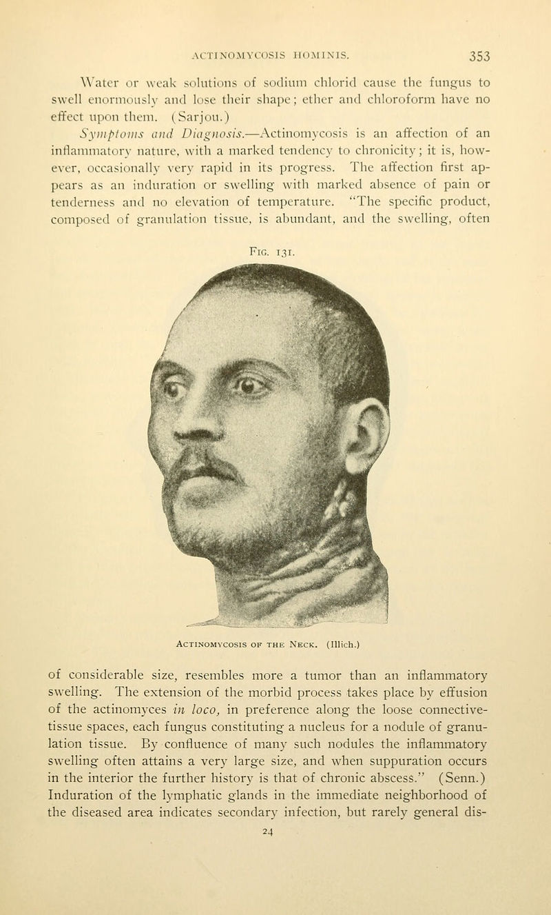 Water or weak solutions of sodium chlorid cause the fungus to swell enormously and lose their shape; ether and chloroform have no effect upon them. (Sarjou.) Syiiiptoiiis and Diagnosis.—Actinomycosis is an affection of an intiammatory nature, with a marked tendency to chronicity; it is, how- ever, occasionally very rapid in its progress. The affection first ap- pears as an induration or swelling with marked absence of pain or tenderness and no elevation of temperature. The specific product, composed of granulation tissue, is abundant, and the swelling, often Fig. 131. Actinomycosis of the Neck. (lUich.) of considerable size, resembles more a tumor than an inflammatory swelling. The extension of the morbid process takes place by eft'usion of the actinomyces in loco, in preference along the loose connective- tissue spaces, each fungus constituting a nucleus for a nodule of granu- lation tissue. By confluence of many such nodules the inflammatory sw^elling often attains a very large size, and when suppuration occurs in the interior the further history is that of chronic abscess. (Senn.) Induration of the lymphatic glands in the immediate neighborhood of the diseased area indicates secondary infection, but rarely general dis- 24