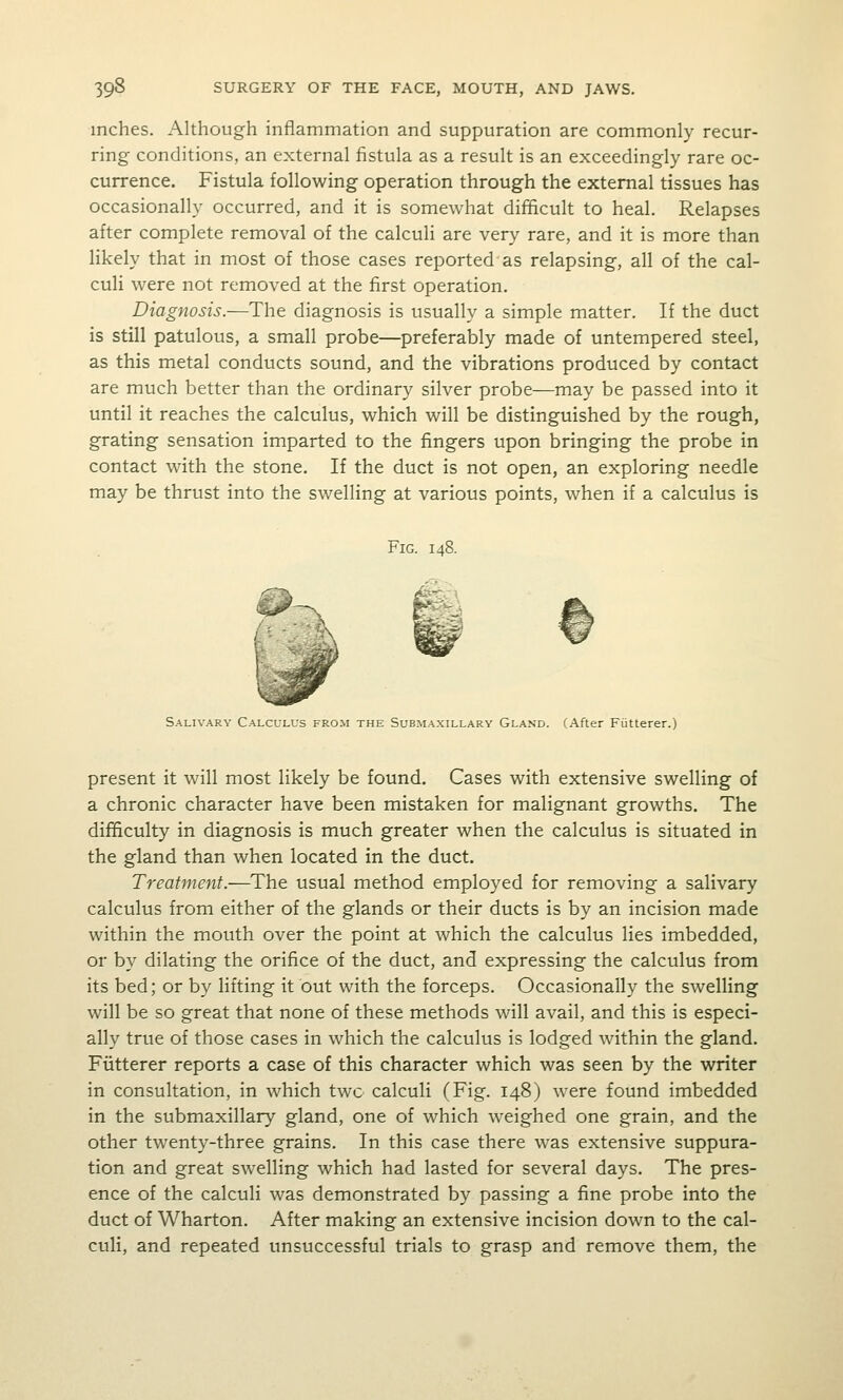 inches. Although inflammation and suppuration are commonly recur- ring conditions, an external fistula as a result is an exceedingly rare oc- currence. Fistula following operation through the external tissues has occasionally occurred, and it is somewhat difficult to heal. Relapses after complete removal of the calculi are very rare, and it is more than likely that in most of those cases reported as relapsing, all of the cal- culi were not removed at the first operation. Diagnosis.—The diagnosis is usually a simple matter. If the duct is still patulous, a small probe—preferably made of untempered steel, as this metal conducts sound, and the vibrations produced by contact are much better than the ordinary silver probe—may be passed into it until it reaches the calculus, which will be distinguished by the rough, grating sensation imparted to the fingers upon bringing the probe in contact with the stone. If the duct is not open, an exploring needle may be thrust into the swelling at various points, when if a calculus is Fig. 148. Salivary Calculus from the Submaxillary Gland. (After Fiitterer.) present it will most likely be found. Cases with extensive swelling of a chronic character have been mistaken for malignant growths. The difficulty in diagnosis is much greater when the calculus is situated in the gland than when located in the duct. Treatment.—The usual method employed for removing a salivary calculus from either of the glands or their ducts is by an incision made within the mouth over the point at which the calculus lies imbedded, or by dilating the orifice of the duct, and expressing the calculus from its bed; or by lifting it out with the forceps. Occasionally the swelling will be so great that none of these methods will avail, and this is especi- ally true of those cases in which the calculus is lodged within the gland. Fiitterer reports a case of this character which was seen by the writer in consultation, in which two calculi (Fig. 148) were found imbedded in the submaxillary gland, one of which weighed one grain, and the other twenty-three grains. In this case there was extensive suppura- tion and great swelling which had lasted for several days. The pres- ence of the calculi was demonstrated by passing a fine probe into the duct of Wharton. After making an extensive incision down to the cal- culi, and repeated unsuccessful trials to grasp and remove them, the