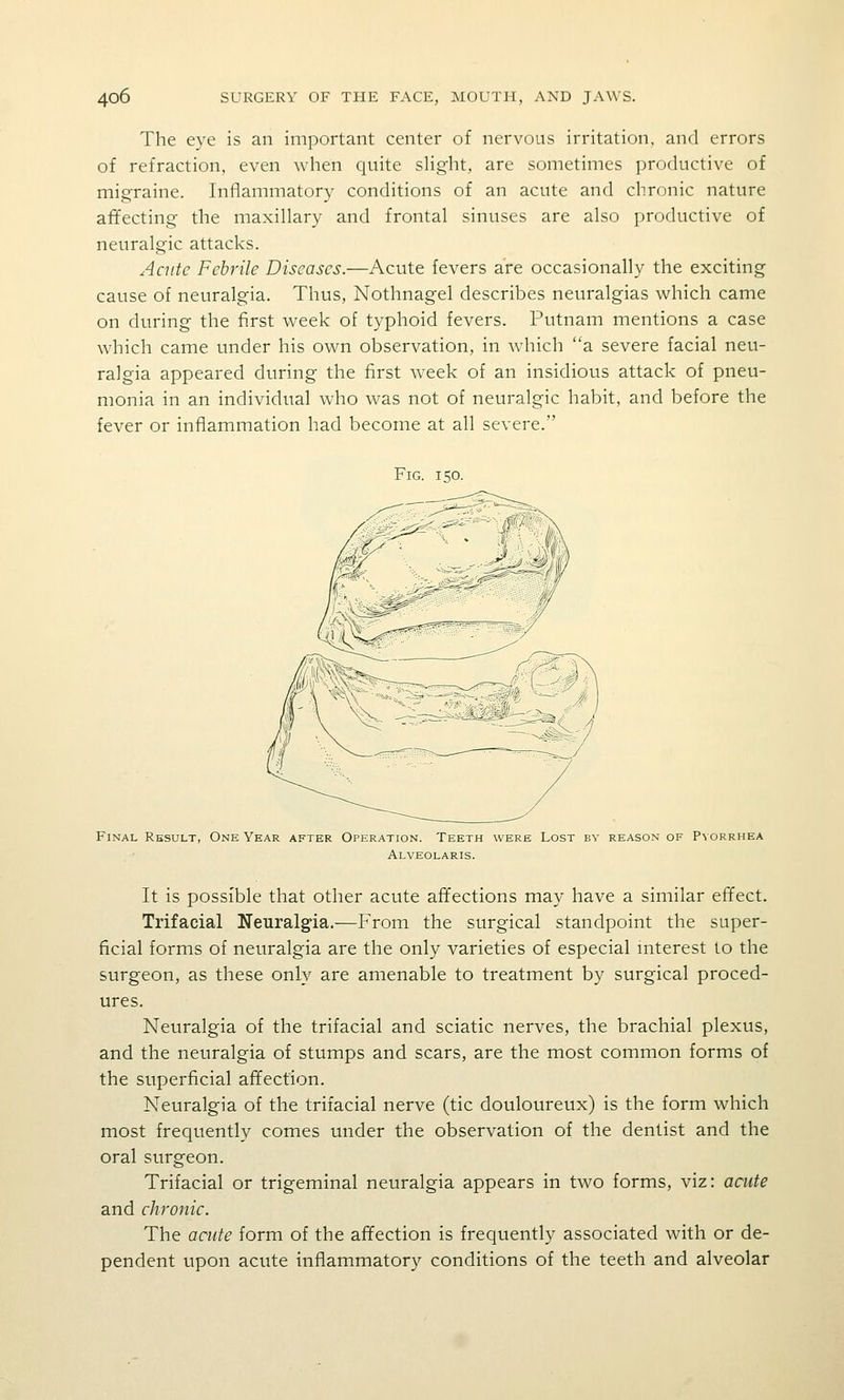 The eye is an important center of nervous irritation, and errors of refraction, even when quite slight, are sometimes productive of migraine. Inflammatory conditions of an acute and chronic nature affecting the maxillary and frontal sinuses are also productive of neuralgic attacks. Acute Febrile Diseases.—Acute fevers are occasionally the exciting cause of neuralgia. Thus, Nothnagel describes neuralgias which came on during the first week of typhoid fevers. Putnam mentions a case which came under his own observation, in which a severe facial neu- ralgia appeared during the first Aveek of an insidious attack of pneu- monia in an individual who was not of neuralgic habit, and before the fever or inflammation had become at all severe. Fig. 150. Final Result, One Year after Operation. Teeth were Lost by reason of Pyorrhea Alveolaris. It is possible that other acute affections may have a similar effect. Trifacial Neuralgia.—From the surgical standpoint the super- ficial forms of neuralgia are the only varieties of especial niterest to the surgeon, as these only are amenable to treatment by surgical proced- ures. Neuralgia of the trifacial and sciatic nerves, the brachial plexus, and the neuralgia of stumps and scars, are the most common forms of the superficial affection. Neuralgia of the trifacial nerve (tic douloureux) is the form which most frequently comes under the observation of the dentist and the oral surgeon. Trifacial or trigeminal neuralgia appears in two forms, viz: acute and chronic. The acute form of the affection is frequently associated with or de- pendent upon acute inflammatory conditions of the teeth and alveolar