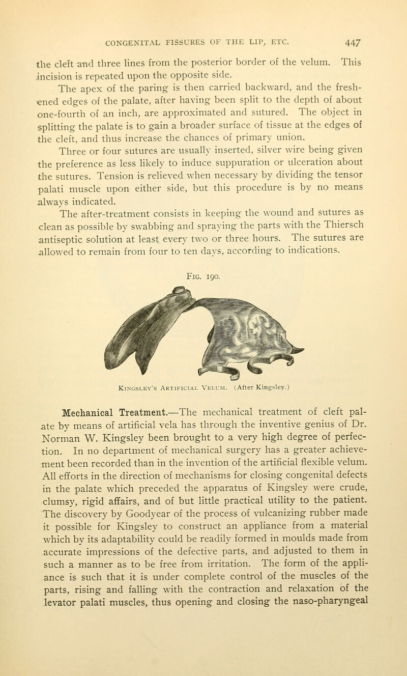 the clelt and three lines from the posterior border of the vekim. This .incision is repeated upon the opposite side. The apex of the paring is then carried backward, and the fresh- ened edges of the palate, after having been split to the depth of about one-fourth of an inch, are approximated and sutured. The object in splitting the palate is to gain a broader surface of tissue at the edges of the cleft, and thus increase the chances of primary union. Three or four sutures are usually inserted, silver wire being given the preference as less likely to induce suppuration or ulceration about the sutures. Tension is relieved when necessary by dividing the tensor palati muscle upon either side, but this procedure is by no means always indicated. The after-treatment consists in keeping the wound and sutures as clean as possible by swabbing and spraying the parts with the Thiersch antiseptic solution at least every two or three hours. The sutures are allowed to remain from four to ten days, according to indications. KiNGSLEY's Artificial Velum. (After Kingsley.) Meclianical Treatment.—The mechanical treatment of cleft pal- ate by means of artificial vela has through the inventive genius of Dr. Norman W. Kingsley been brought to a very high degree of perfec- tion. In no department of mechanical surgery has a greater achieve- :ment been recorded than in the invention of the artificial flexible velum. All efforts in the direction of mechanisms for closing congenital defects in the palate which preceded the apparatus of Kingsley were crude, clumsy, rigid aflfairs, and of but little practical utility to the patient. The discovery by Goodyear of the process of vulcanizing rubber made it possible for Kingsley to construct an appliance from a material which by its adaptability could be readily formed in moulds made from .accurate impressions of the defective parts, and adjusted to them in such a manner as to be free from irritation. The form of the appli- ance is such that it is under complete control of the muscles of the parts, rising and falling with the contraction and relaxation of the [levator palati muscles, thus opening and closing the naso-pharyngeal