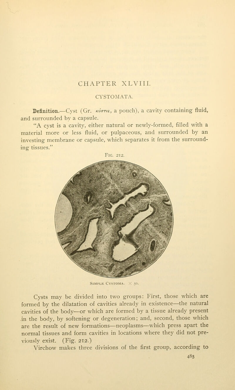 CHAPTER XLVIII. CYSTOMATA. Definition.—Cyst (Or. KiWts, a pouch), a cavity containing fluid, and surrounded by a capsule. A cyst is a cavity, either natural or newly-formed, filled with a material more or less fluid, or pulpaceous, and surrounded by an investing membrane or capsule, which separates it from the surround- ing tissues. Fig. 212. Simple Cystoma. Cysts may be divided into two groups: P'irst, those which are formed by the dilatation of cavities already in existence—the natural cavities of the body—or which are formed by a tissue already present in the body, by softening or degeneration; and, second, those which are the result of new formations—neoplasms—which press apart the normal tissues and form cavities in locations where they did not pre- viously exist. (Fig. 212.) Virchow makes three divisions of the first group, according to