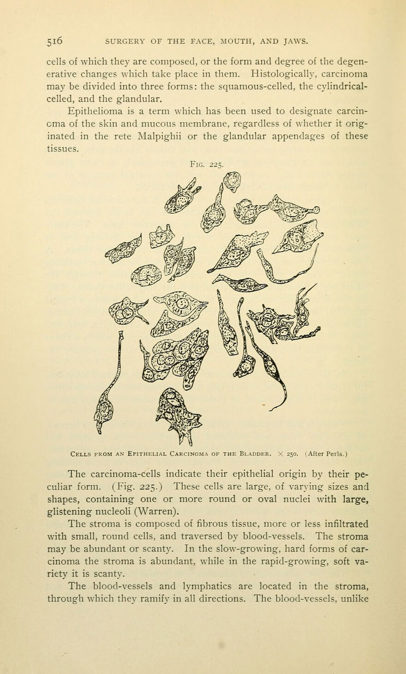 cells of which they are composed, or the form and degree of the degen- erative changes which take place in them. Histologically, carcinoma may be divided into three forms: the squamous-celled, the cylindrical- celled, and the glandular. Epithelioma is a term which has been used to designate carcin- oma of the skin and mucous membrane, regardless of whether it orig- inated in the rete Malpighii or the glandular appendages of these tissues. Fig. 225. Cells from an Epithelial Carcinoma of the Bladder. X 250. (After Perls.) The carcinoma-cells indicate their epithelial origin by their pe- culiar form. (Fig. 225.) These cells are large, of varying sizes and shapes, containing one or more round or oval nuclei with large, glistening nucleoli (Warren). The stroma is composed of fibrous tissue, more or less infiltrated with small, round cells, and traversed by blood-vessels. The stroma may be abundant or scanty. In the slow-growing, hard forms of car- cinoma the stroma is abundant, while in the rapid-growing, soft va- riety it is scanty. The blood-vessels and lymphatics are located in the stroma, through which they ramify in all directions. The blood-vessels, unlike