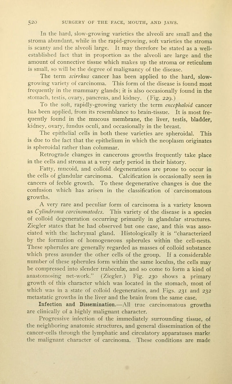 In the hard, slow-growing varieties the alveoH are small and the stroma abundant, while in the rapid-growing, soft varieties the stroma is scanty and the alveoli large. It may therefore be stated as a well- established fact that in proportion as the alveoli are large and the amount of connective tissue which makes up the stroma or reticulum is small, so will be the degree of malignancy of the disease. The term scirrhus cancer has been applied to the hard, slow- growing variety of carcinoma. This form of the disease is found most frequently in the mammary glands; it is also occasionally found in the stomach, testis, ovary, pancreas, and kidney. (Fig. 229.) To the soft, rapidly-growing variety the term encephaloid cancer has been applied, from its resemblance to brain-tissue. It is most fre- quently found in the mucous membrane, the liver, testis, bladder, kidney, ovary, fundus oculi, and occasionally in the breast. The epithelial cells in both these varieties are spheroidal. This is due to the fact that the epithelium in which the neoplasm originates is spheroidal rather than columnar. Retrograde changes in cancerous growths frequently take place in the cells and stroma at a very early period in their history. Fatty, mucoid, and colloid degenerations are prone to occur in the cells of glandular carcinoma. Calcification is occasionally seen in cancers of feeble growth. To these degenerative changes is due the confusion which has arisen in the classification of carcinomatous growths. A very rare and peculiar form of carcinoma is a variety known as Cylindroma carcinomatodcs. This variety of the disease is a species of colloid degeneration occurring primarily in glandular structures. Ziegler states that he had observed but one case, and this was asso- ciated with the lachrymal gland. Histologically it is characterized by the formation of homogeneous spherules within the cell-nests. These spherules are generally regarded as masses of colloid substance which press asunder the other cells of the group. If a considerable number of these spherules form within the same loculus, the cells may be compressed into slender trabeculse, and so come to form a kind of anastomosing net-work. (Ziegler.) Fig. 230 shows a primary growth of this character which was located in the stomach, most of which was in a state of colloid degeneration, and Figs. 231 and 232 metastatic growths in the liver and the brain from the same case. Infection and Dissemination.—All true carcinomatous growths are clinically of a highly malignant character. Progressive infection of the immediately surrounding tissue, of the neighboring anatomic structures, and general dissemination of the cancer-cells through the lymphatic and circulatory apparatuses mark? the malignant character of carcinoma. These conditions are made